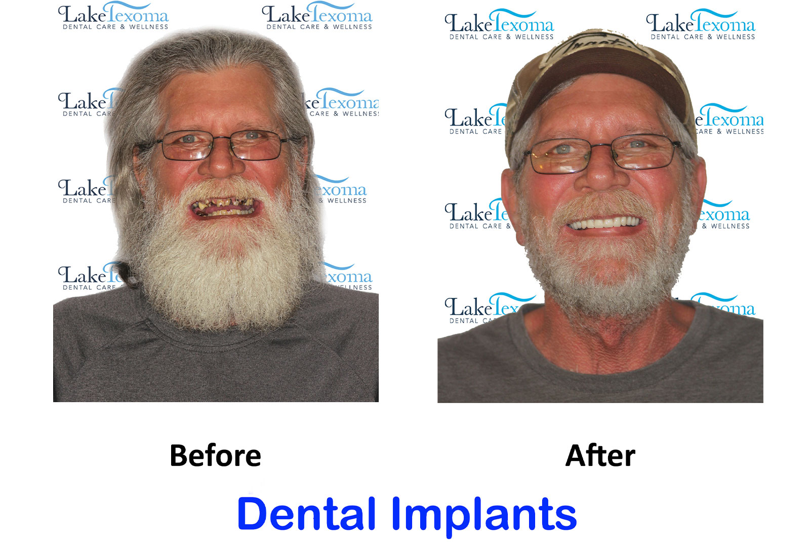 Headshot of patients before and after procedure
