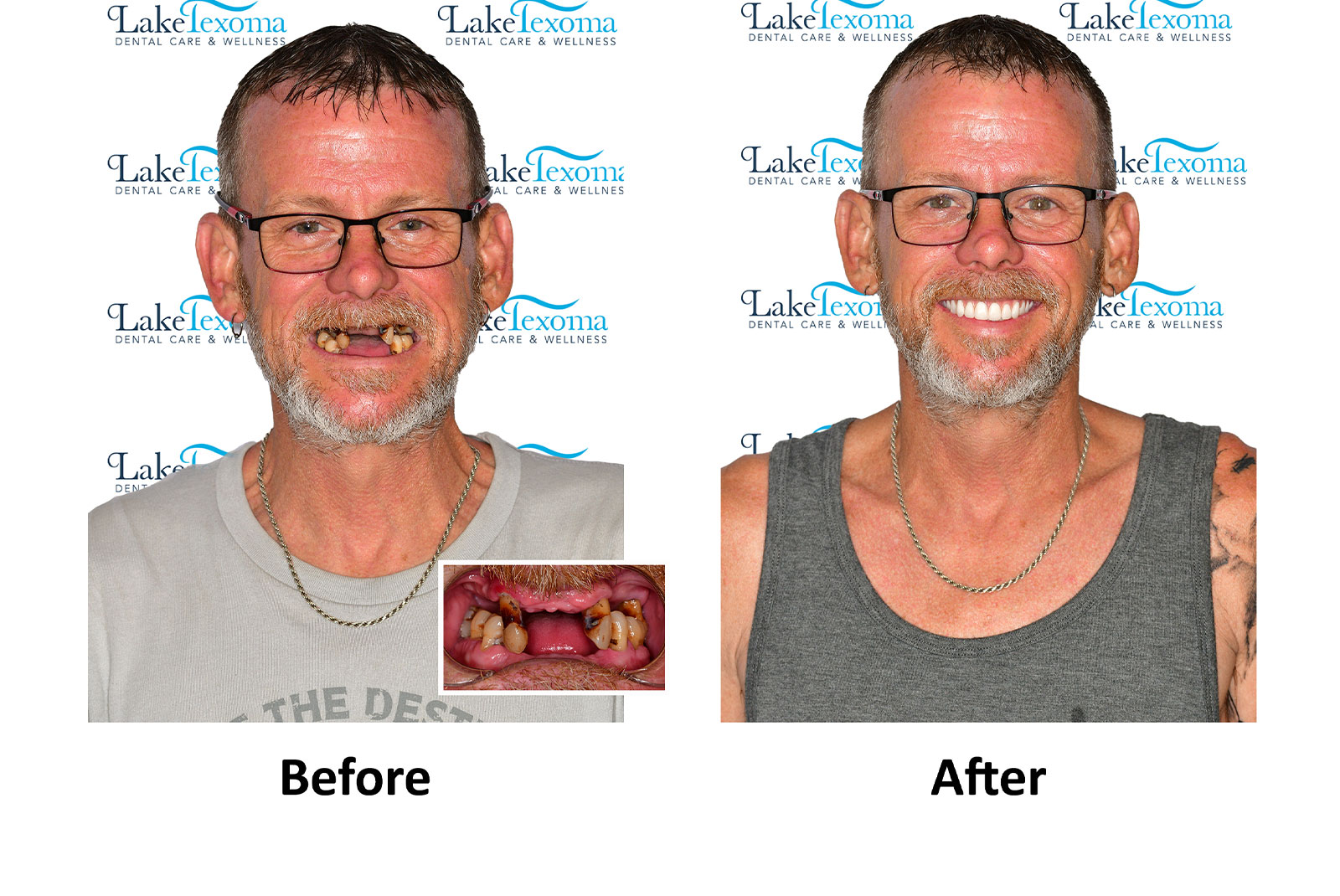 Headshot of patients before and after procedure