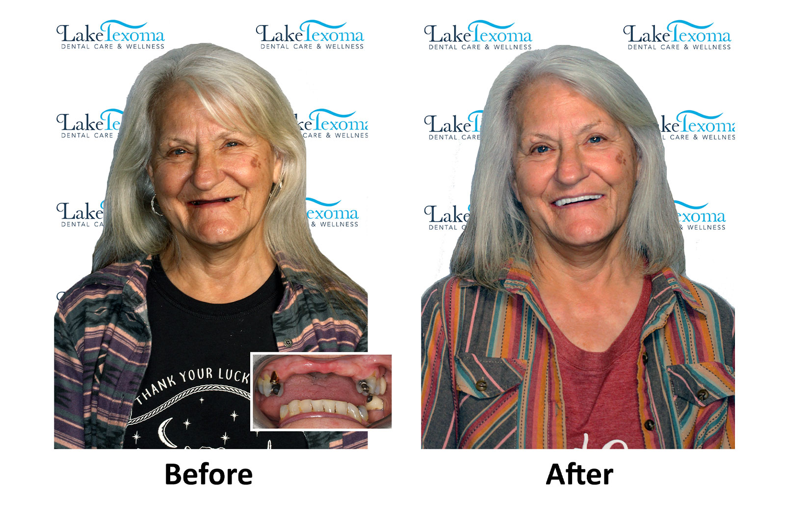 Headshot of patients before and after procedure