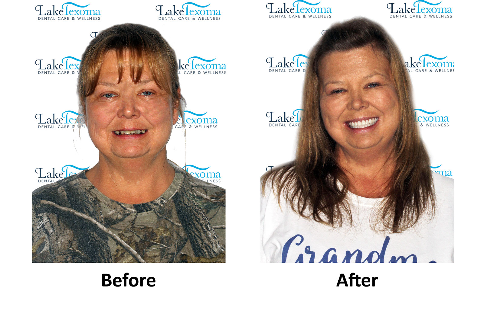 Headshot of patients before and after procedure