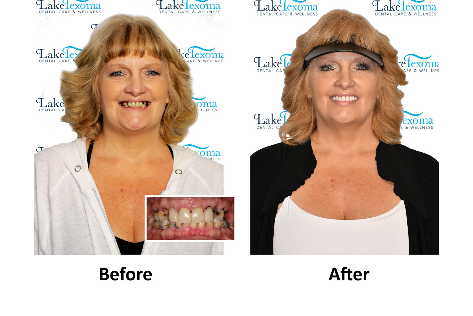 Headshot of patients before and after procedure