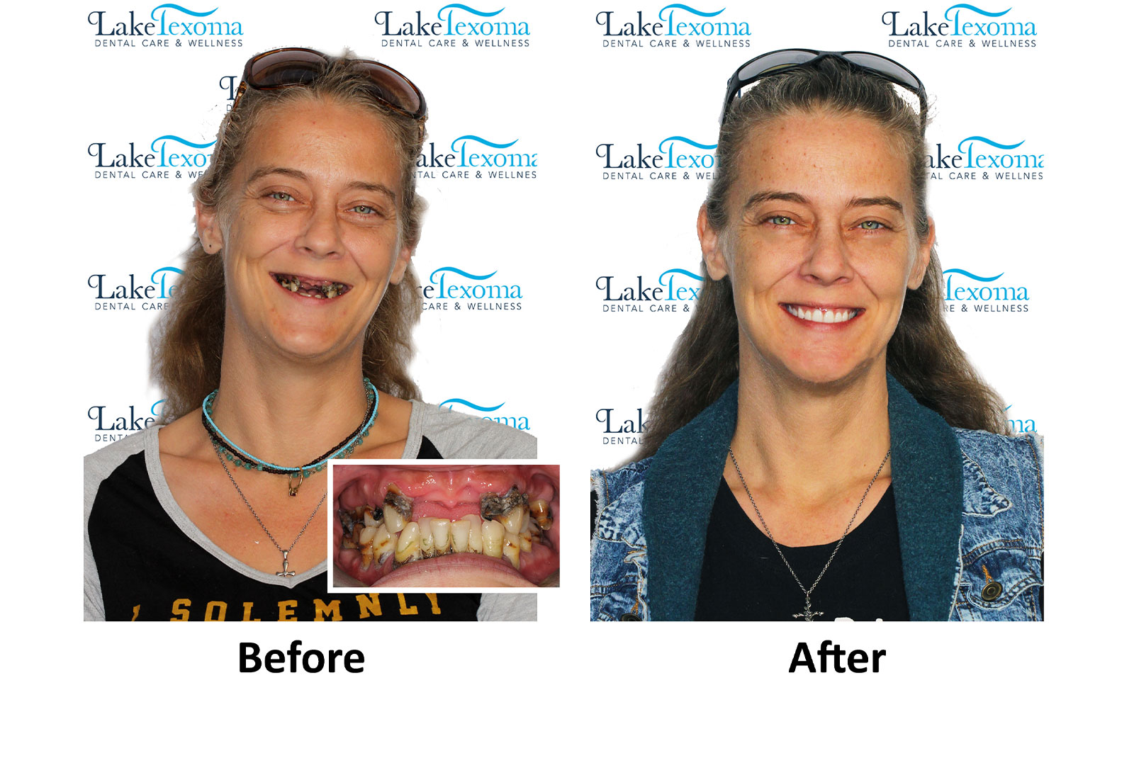 Headshot of patients before and after procedure