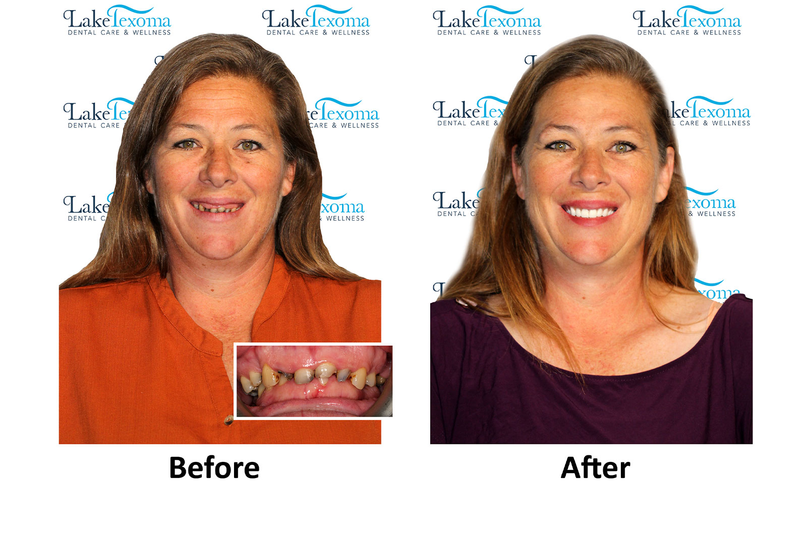 Headshot of patients before and after procedure