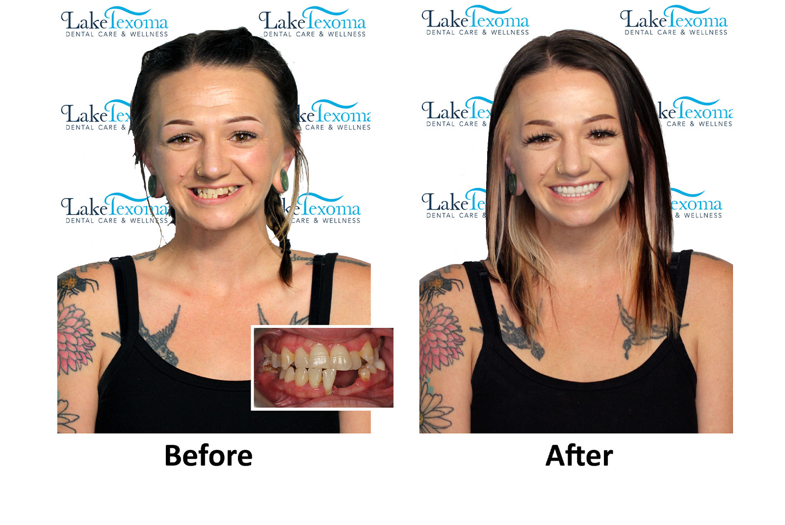 Headshot of patients before and after procedure