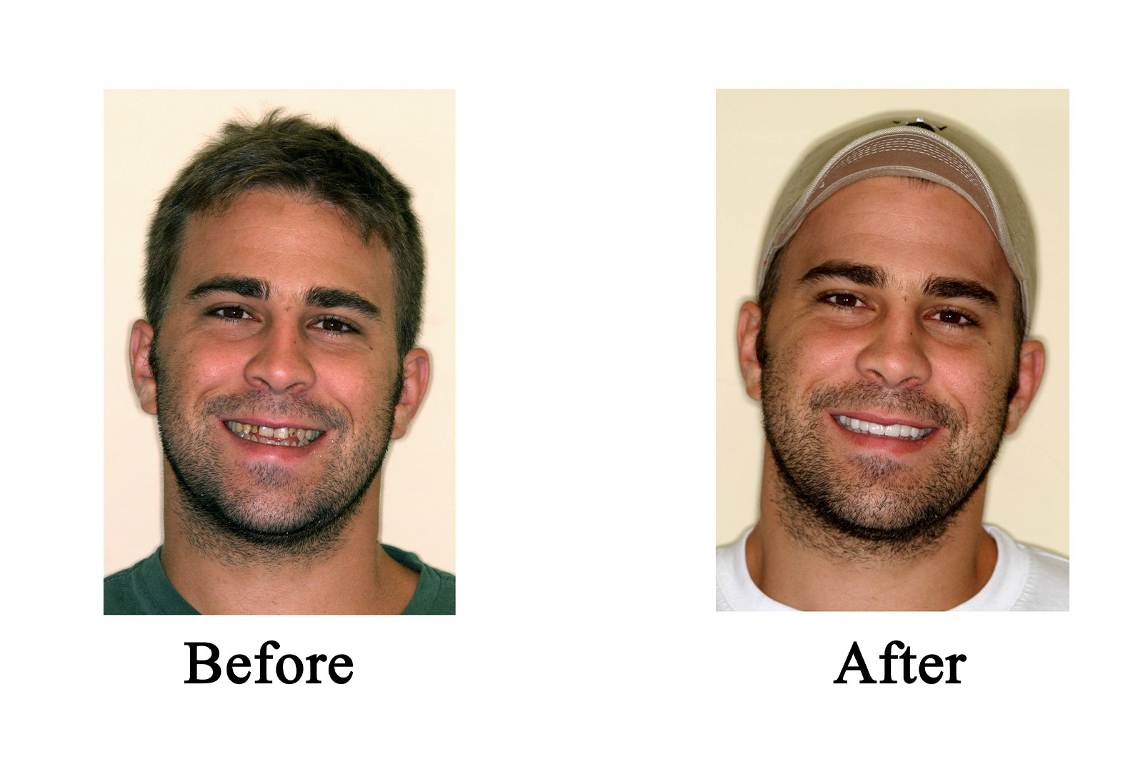 Headshot of patients before and after procedure