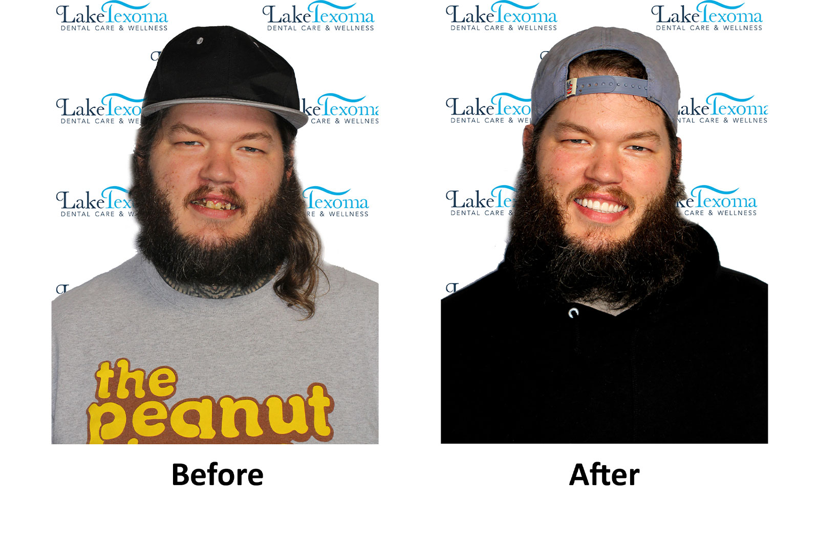 Headshot of patients before and after procedure