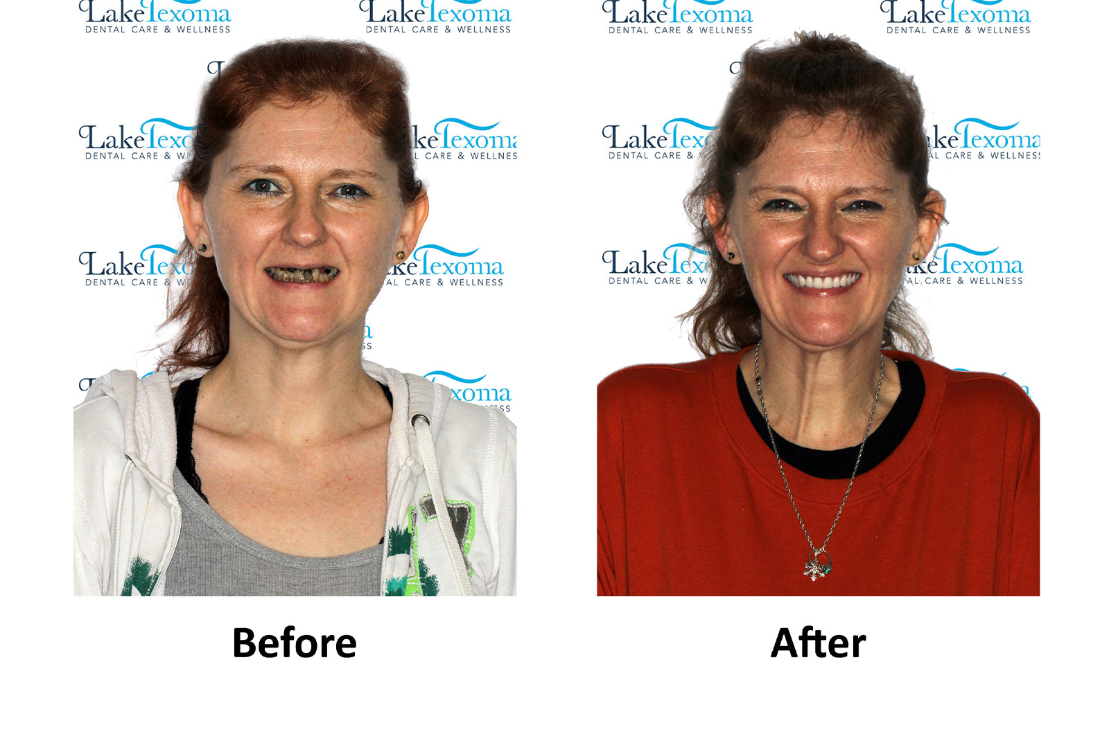Headshot of patients before and after procedure