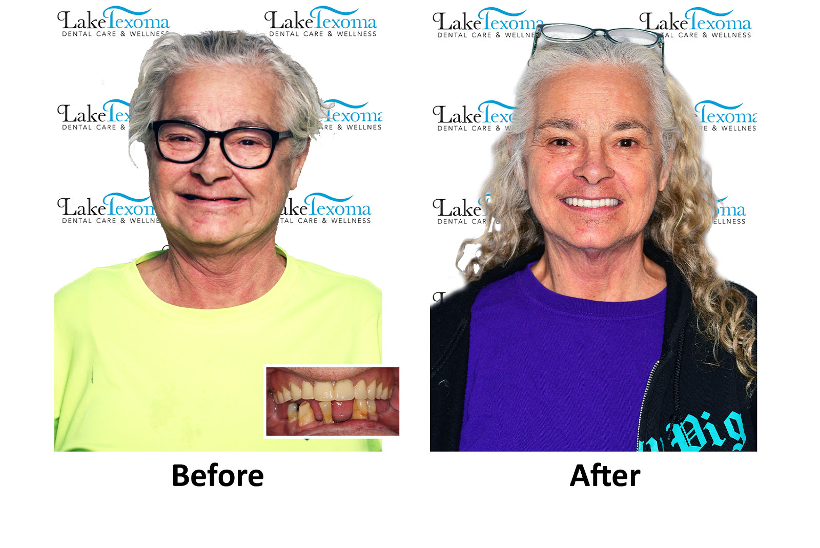 Headshot of patients before and after procedure