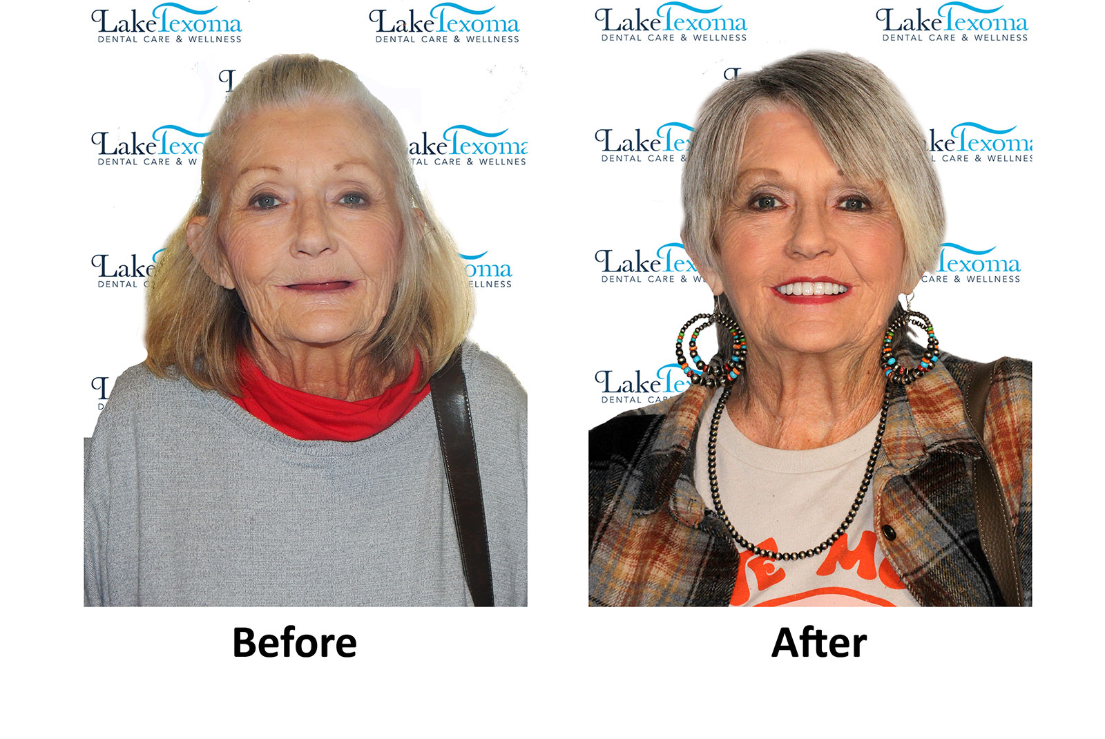 Headshot of patients before and after procedure