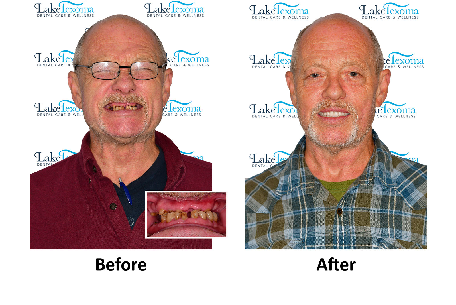 Headshot of patients before and after procedure