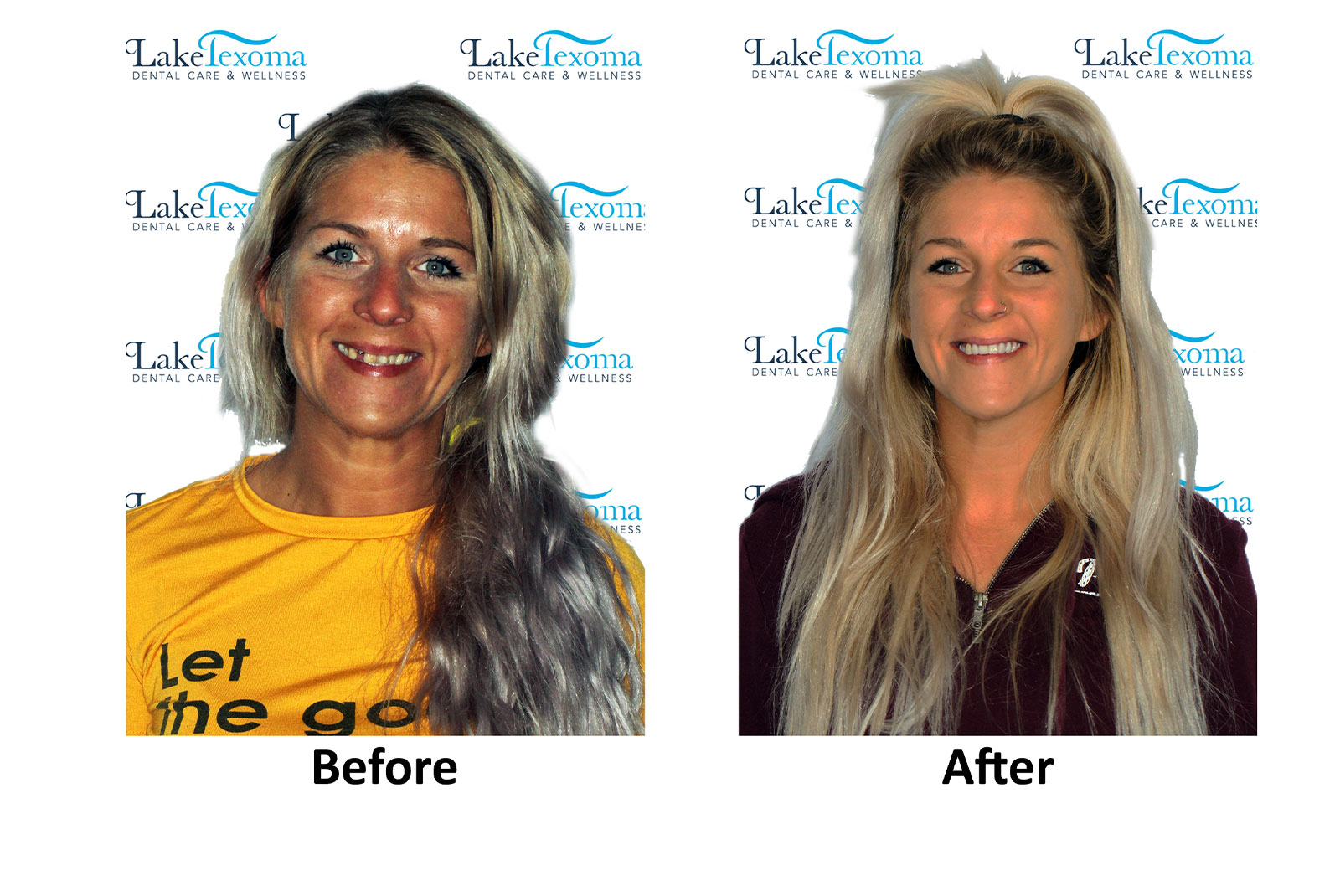 Headshot of patients before and after procedure