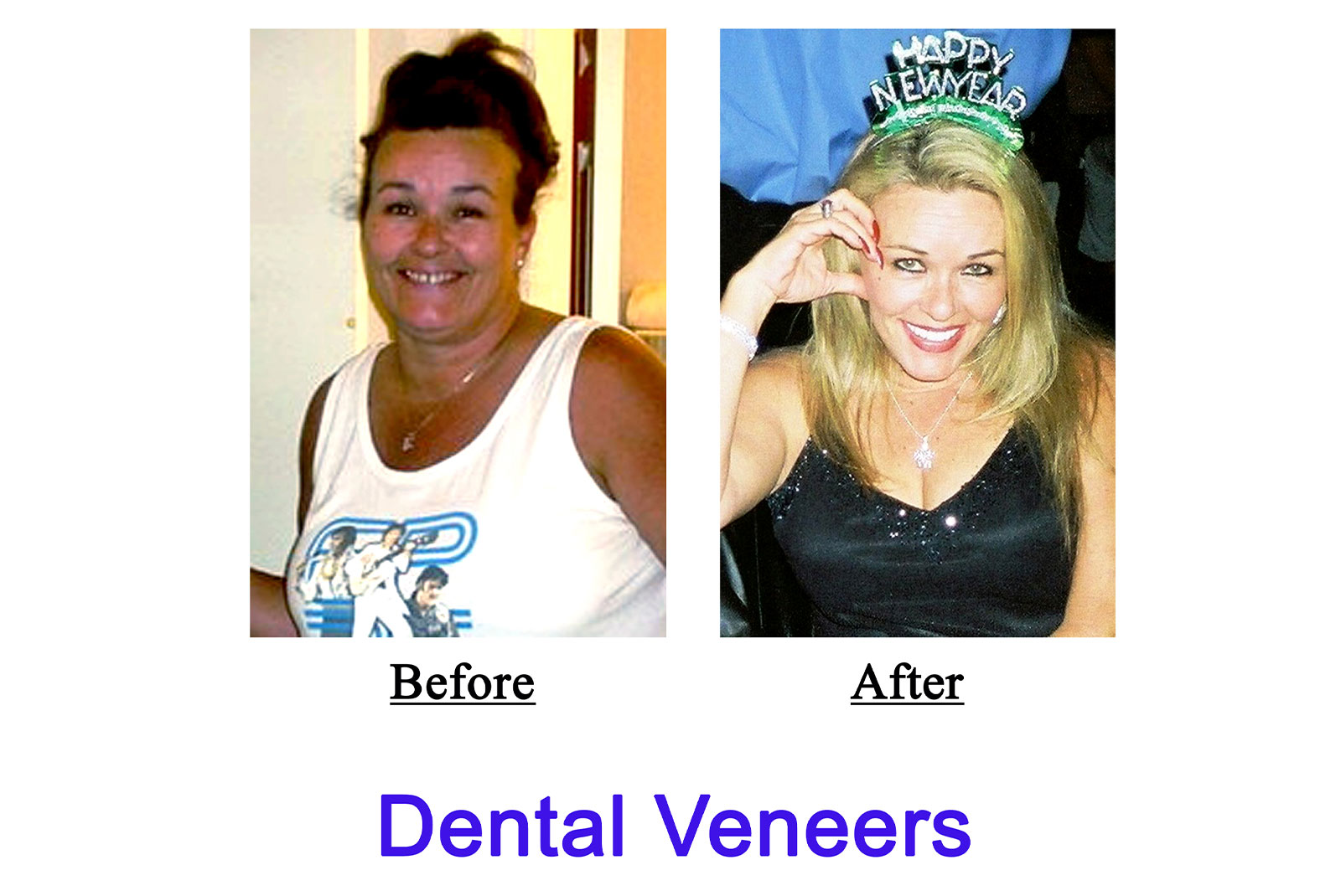 Headshot of patients before and after procedure