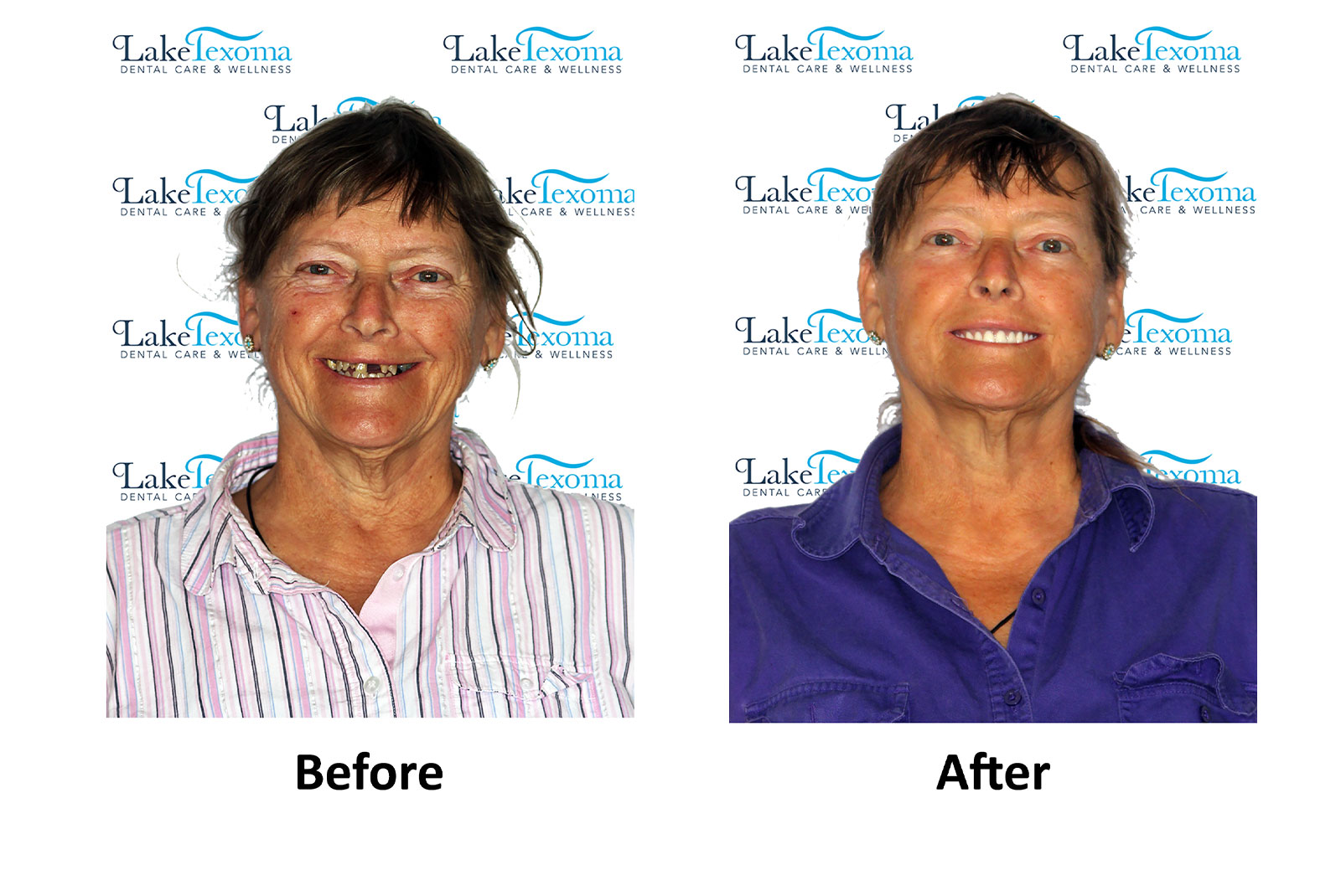 Headshot of patients before and after procedure