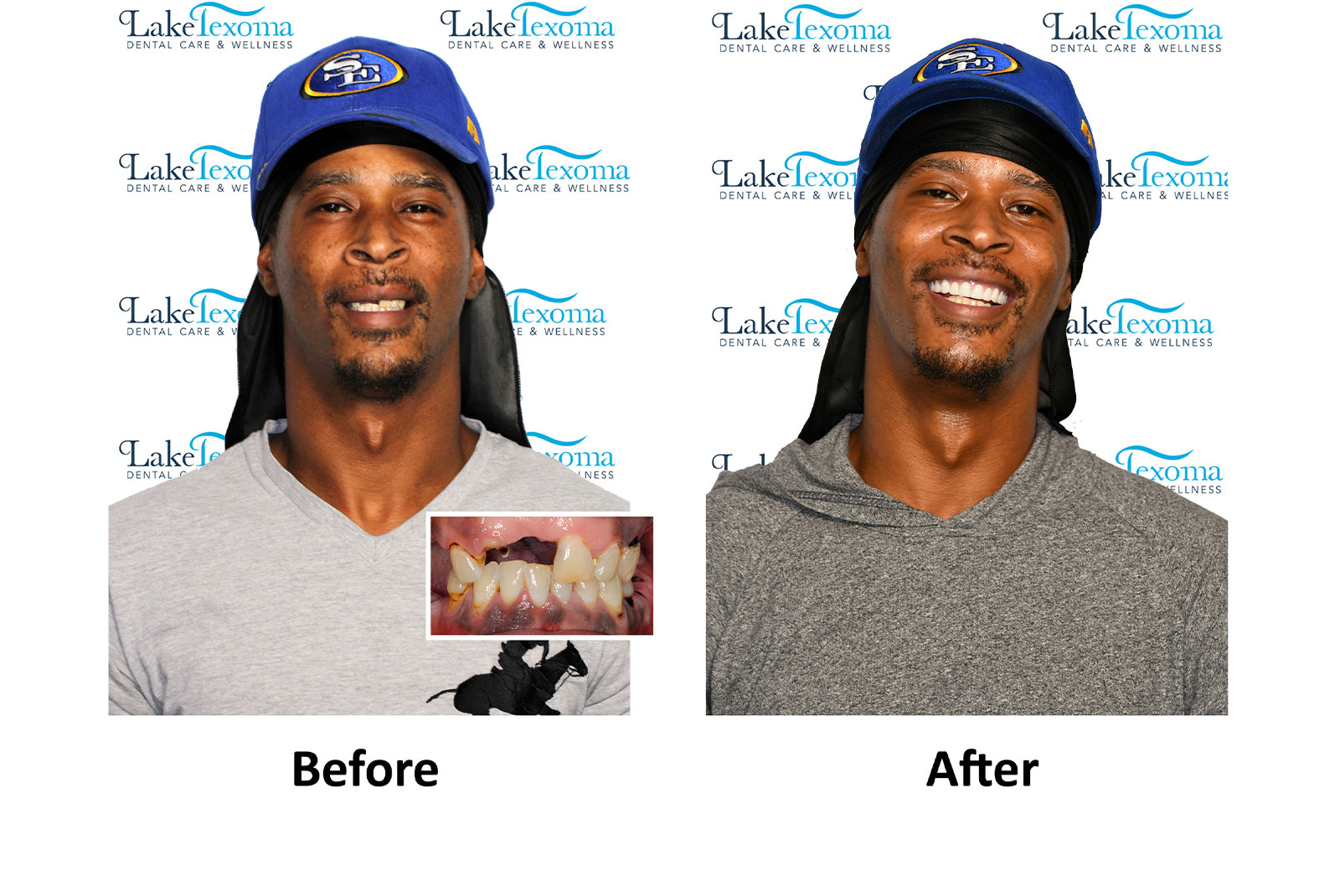 Headshot of patients before and after procedure