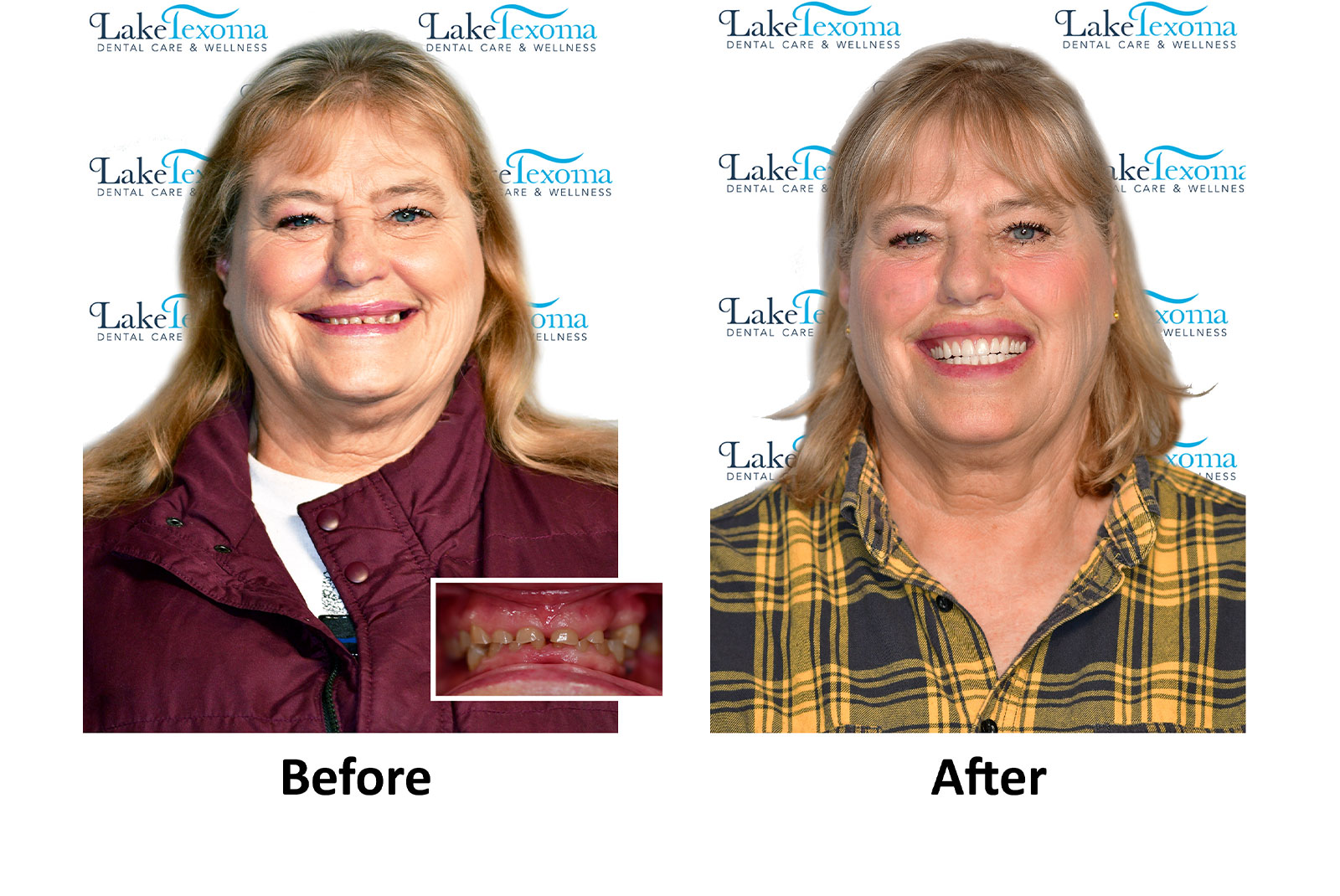 Headshot of patients before and after procedure