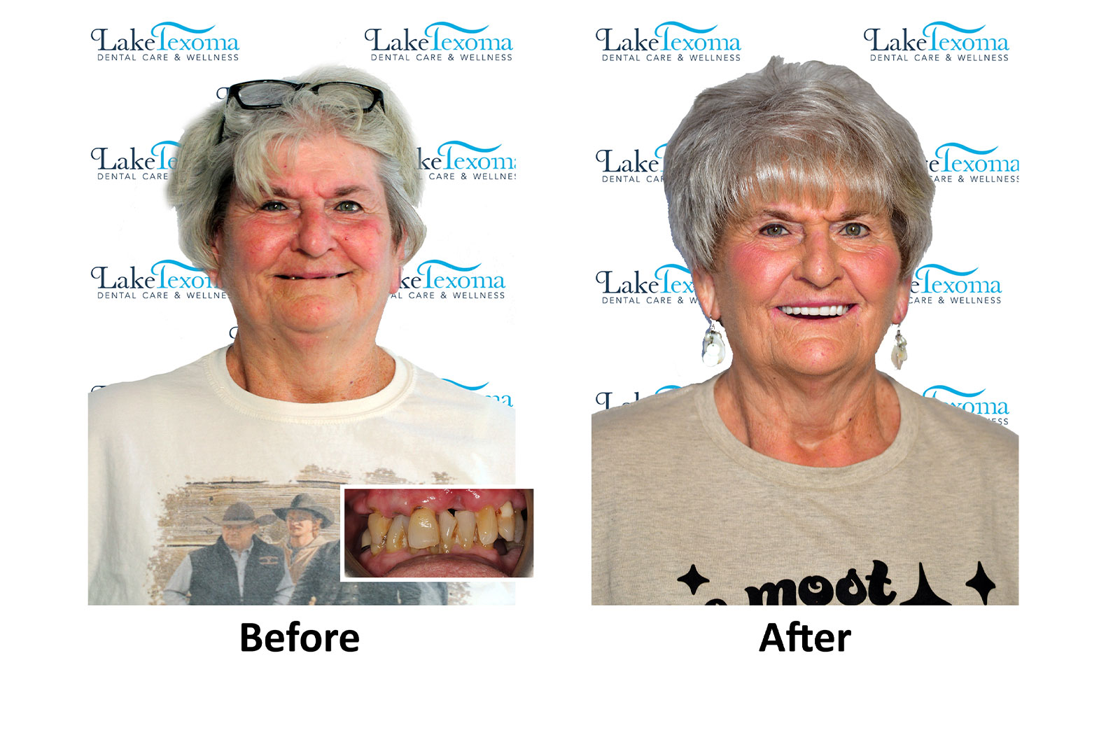 Headshot of patients before and after procedure