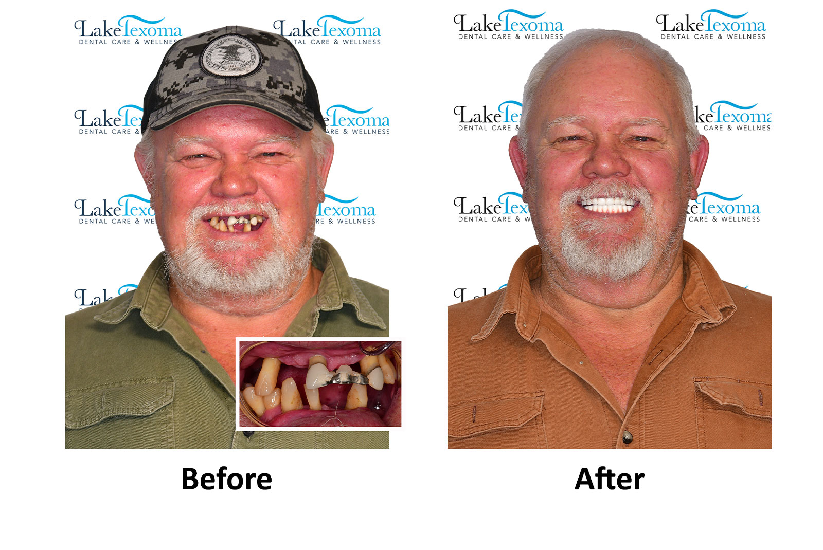 Headshot of patients before and after procedure