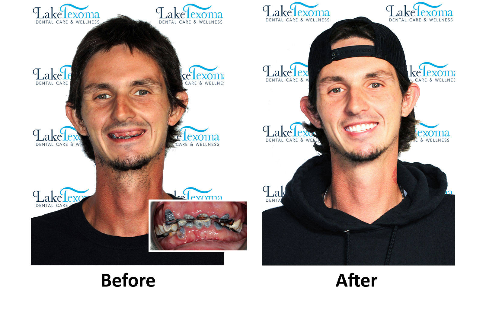 Headshot of patients before and after procedure