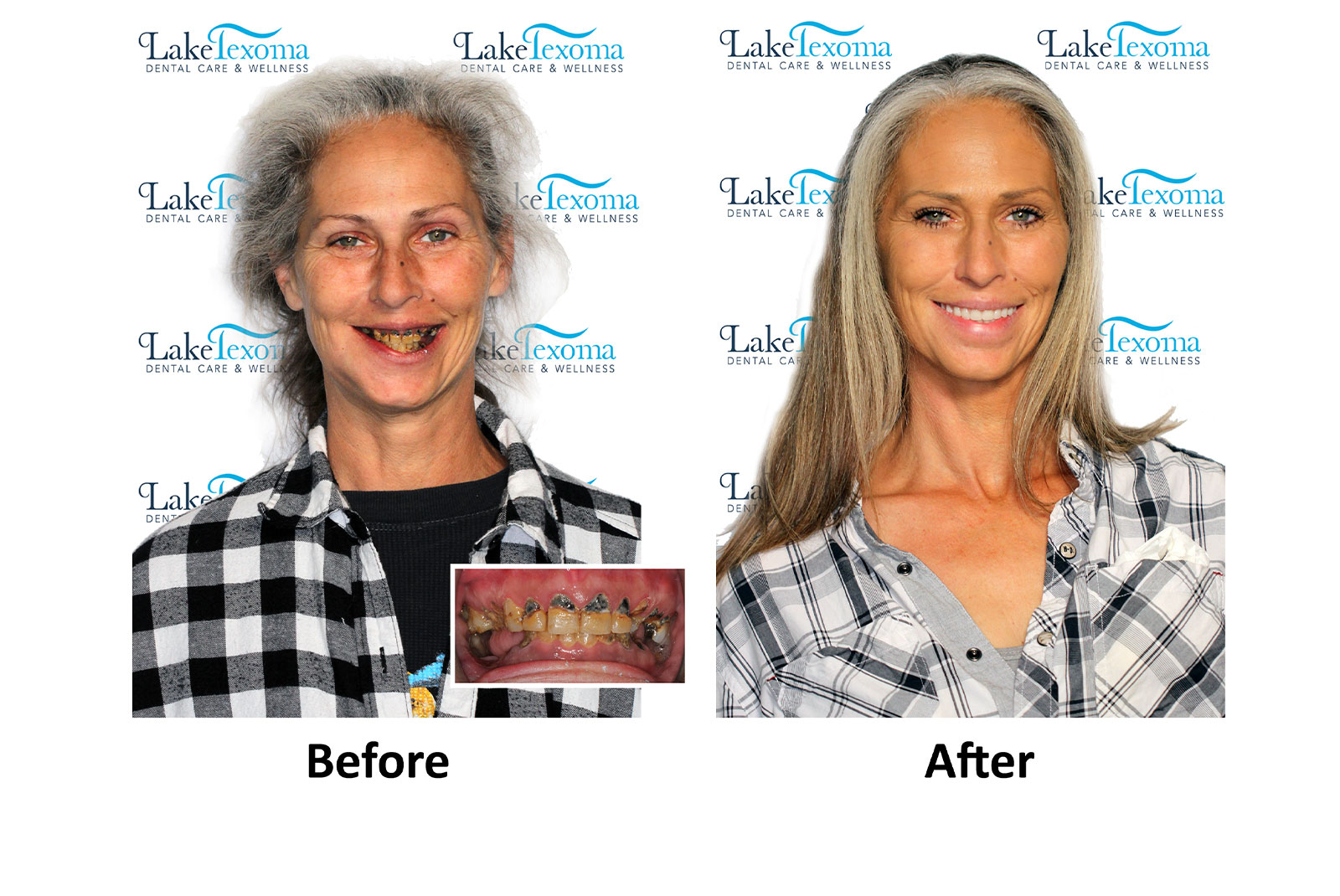 Headshot of patients before and after procedure