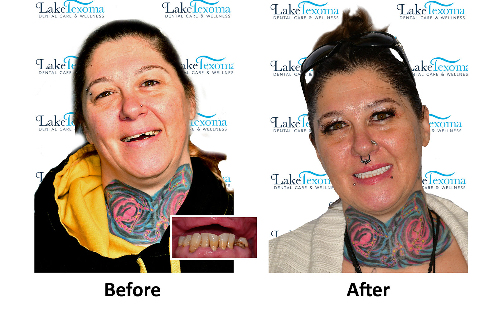 Headshot of patients before and after procedure