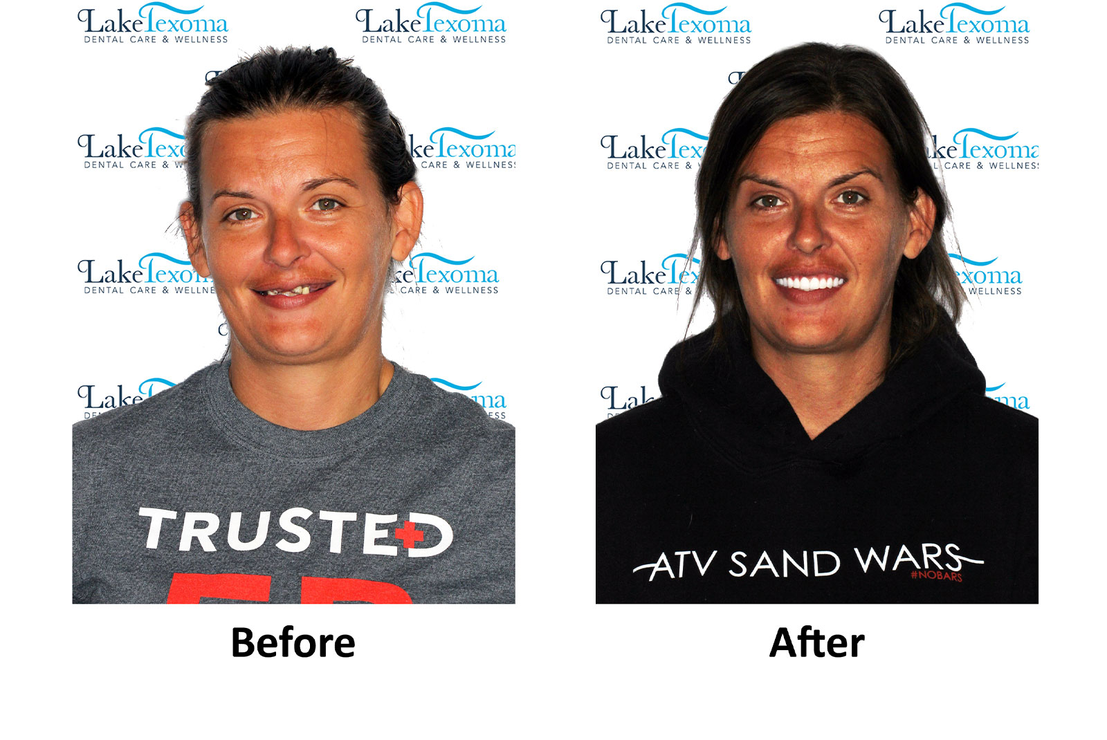 Headshot of patients before and after procedure