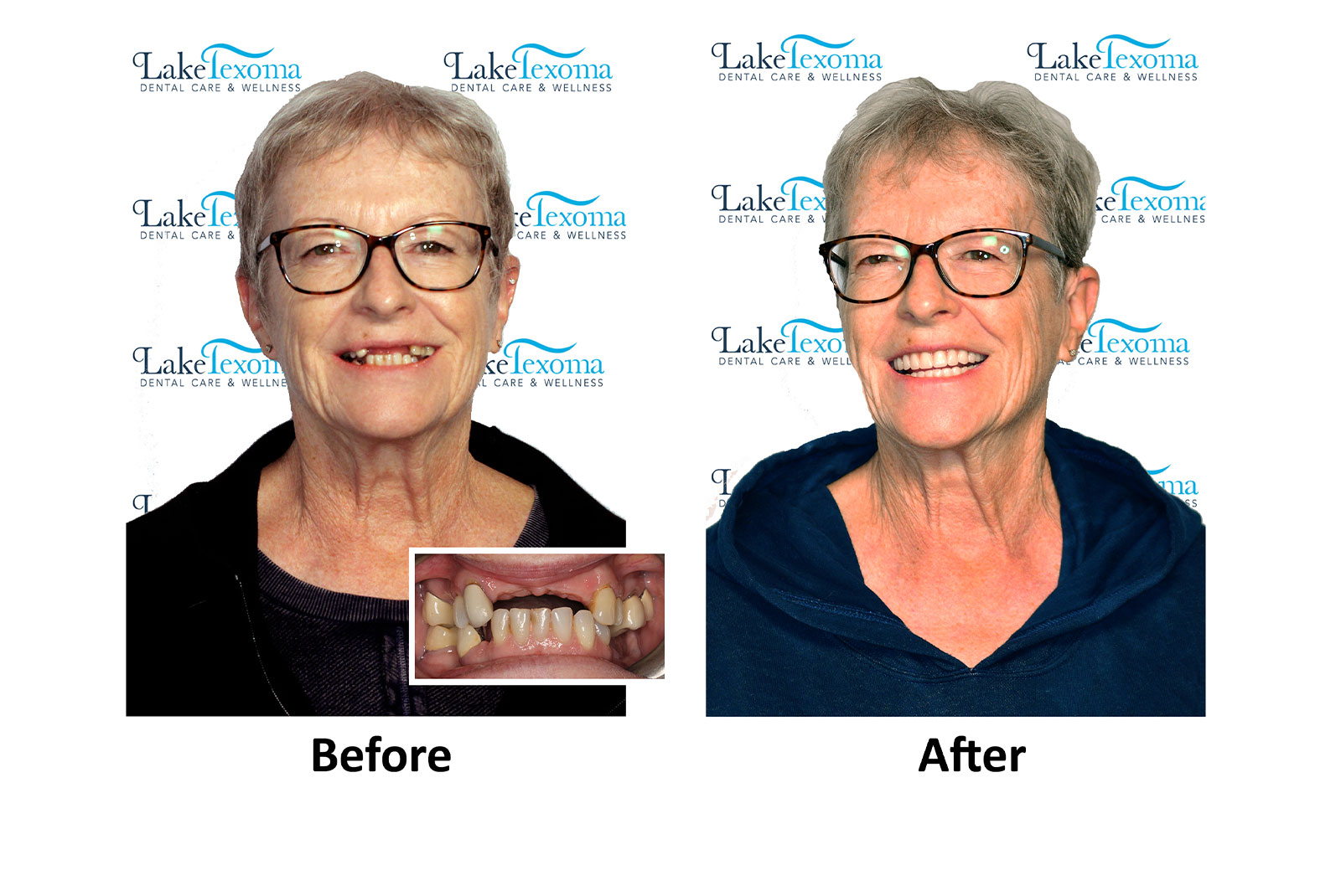 Headshot of patients before and after procedure