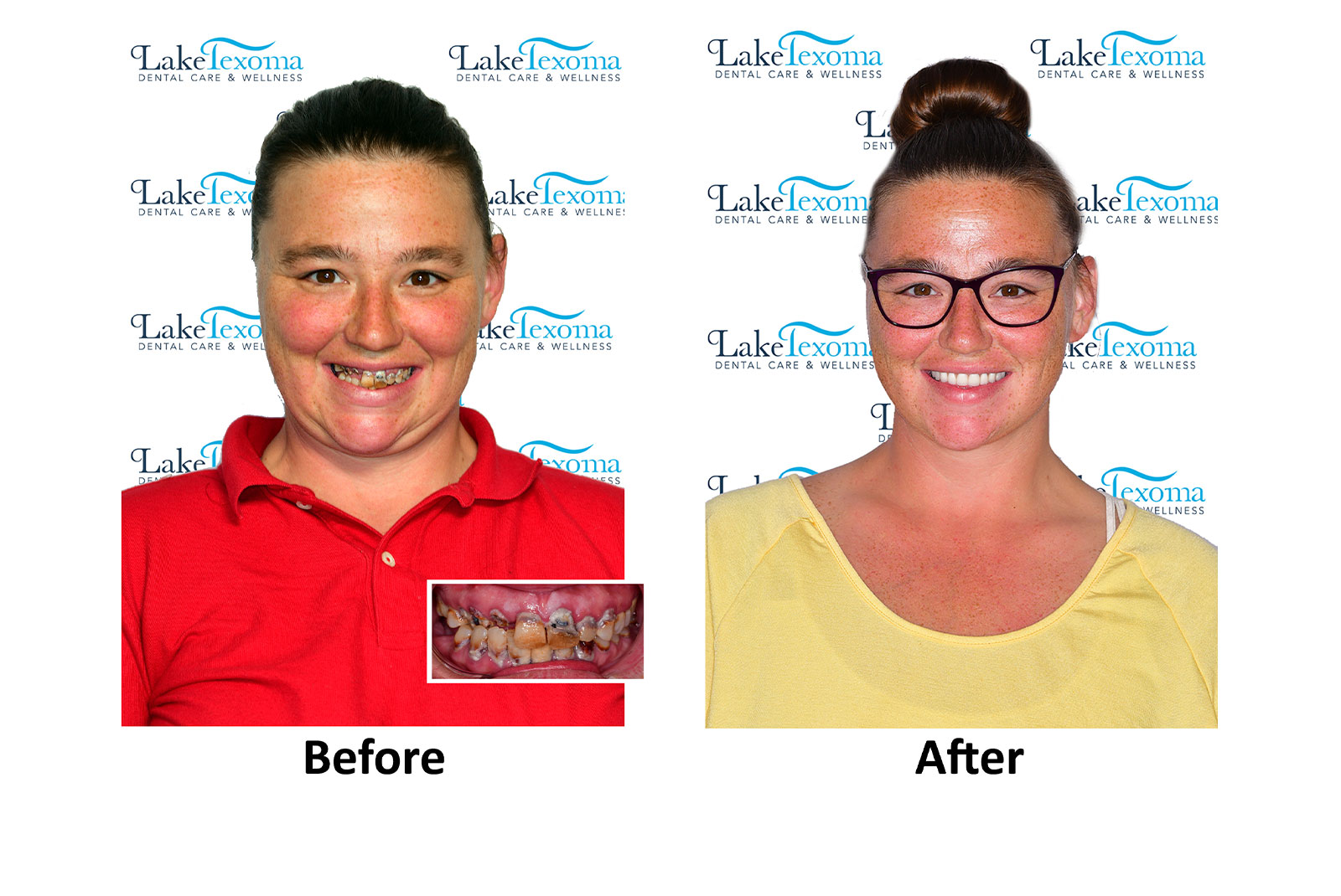 Headshot of patients before and after procedure