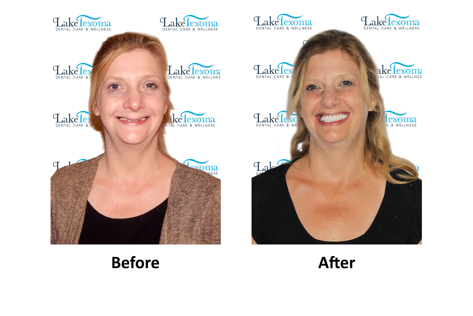 Headshot of patients before and after procedure