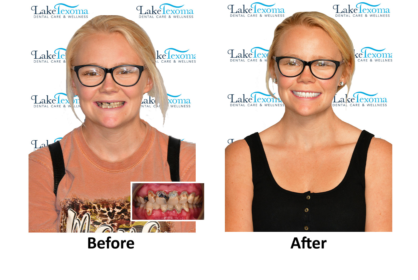 Headshot of patients before and after procedure
