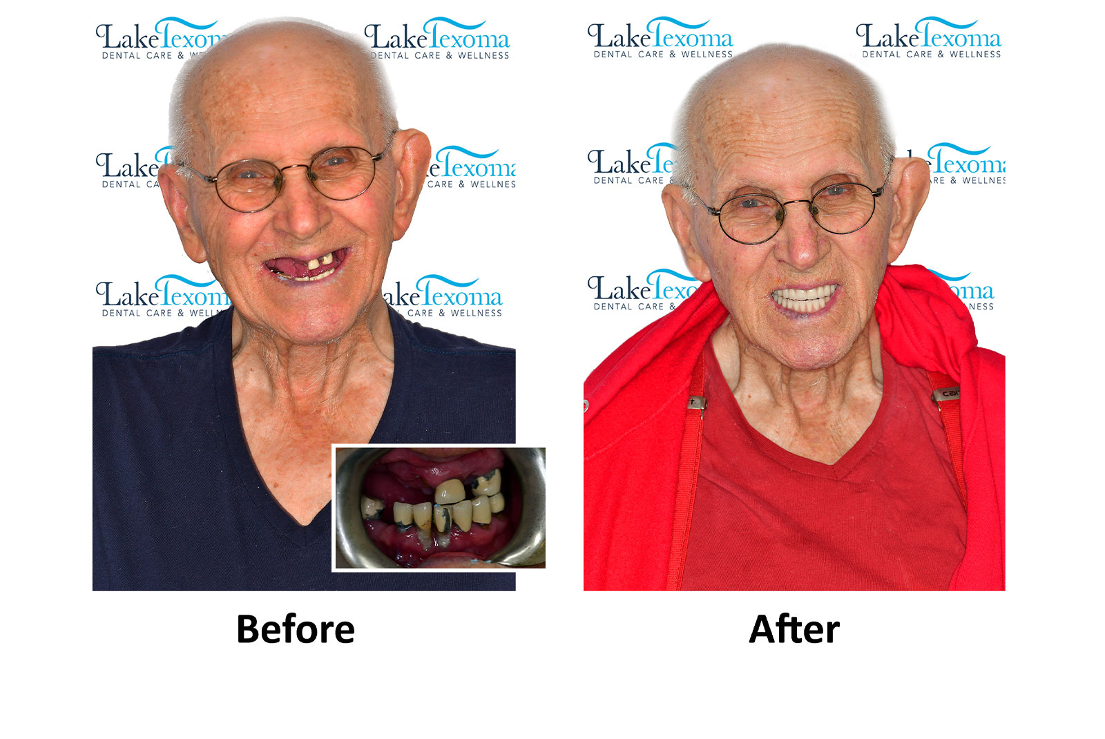 Headshot of patients before and after procedure
