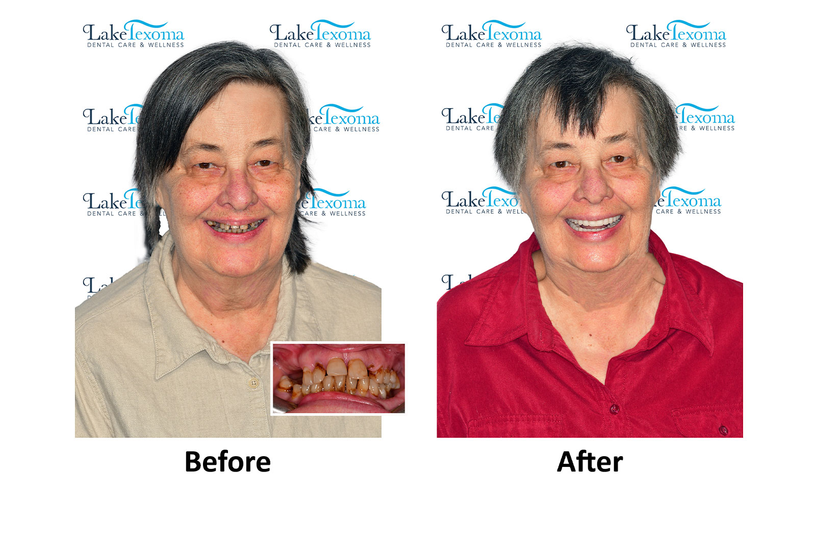 Headshot of patients before and after procedure