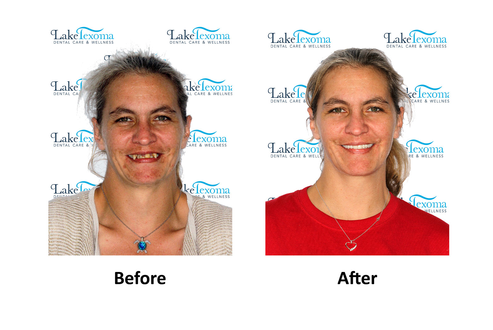 Headshot of patients before and after procedure