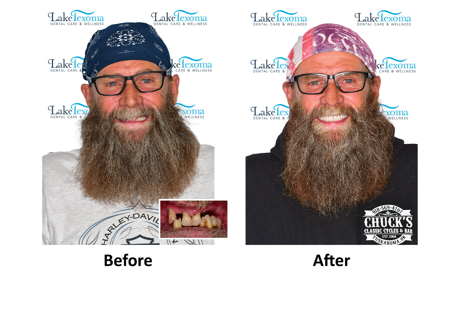 Headshot of patients before and after procedure