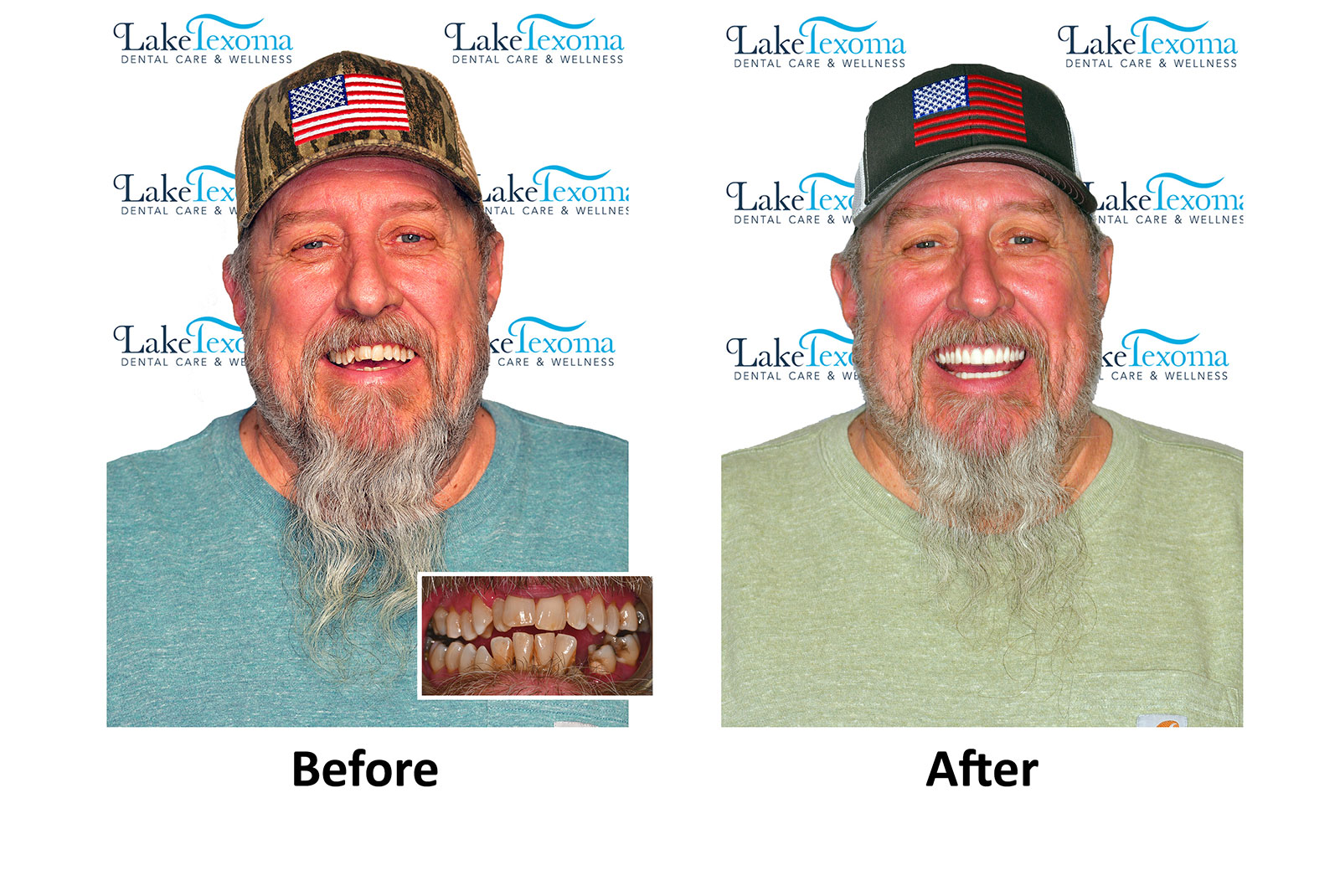 Headshot of patients before and after procedure