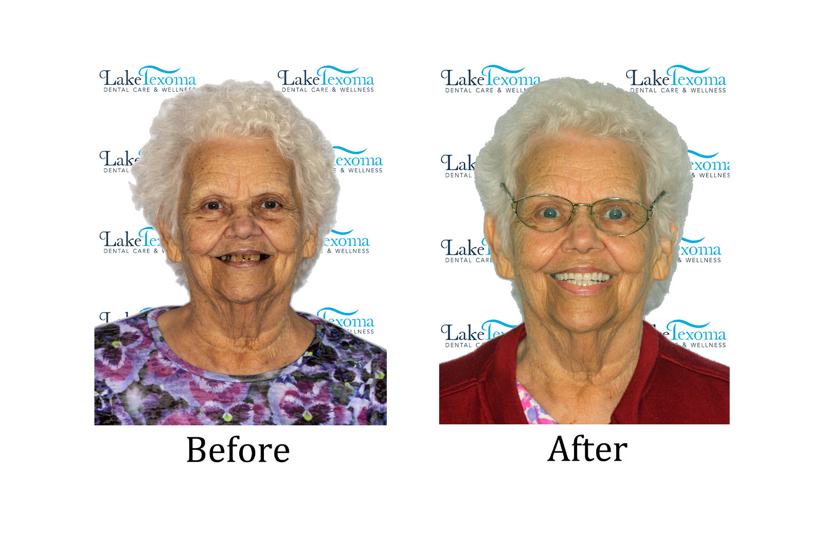 Headshot of patients before and after procedure