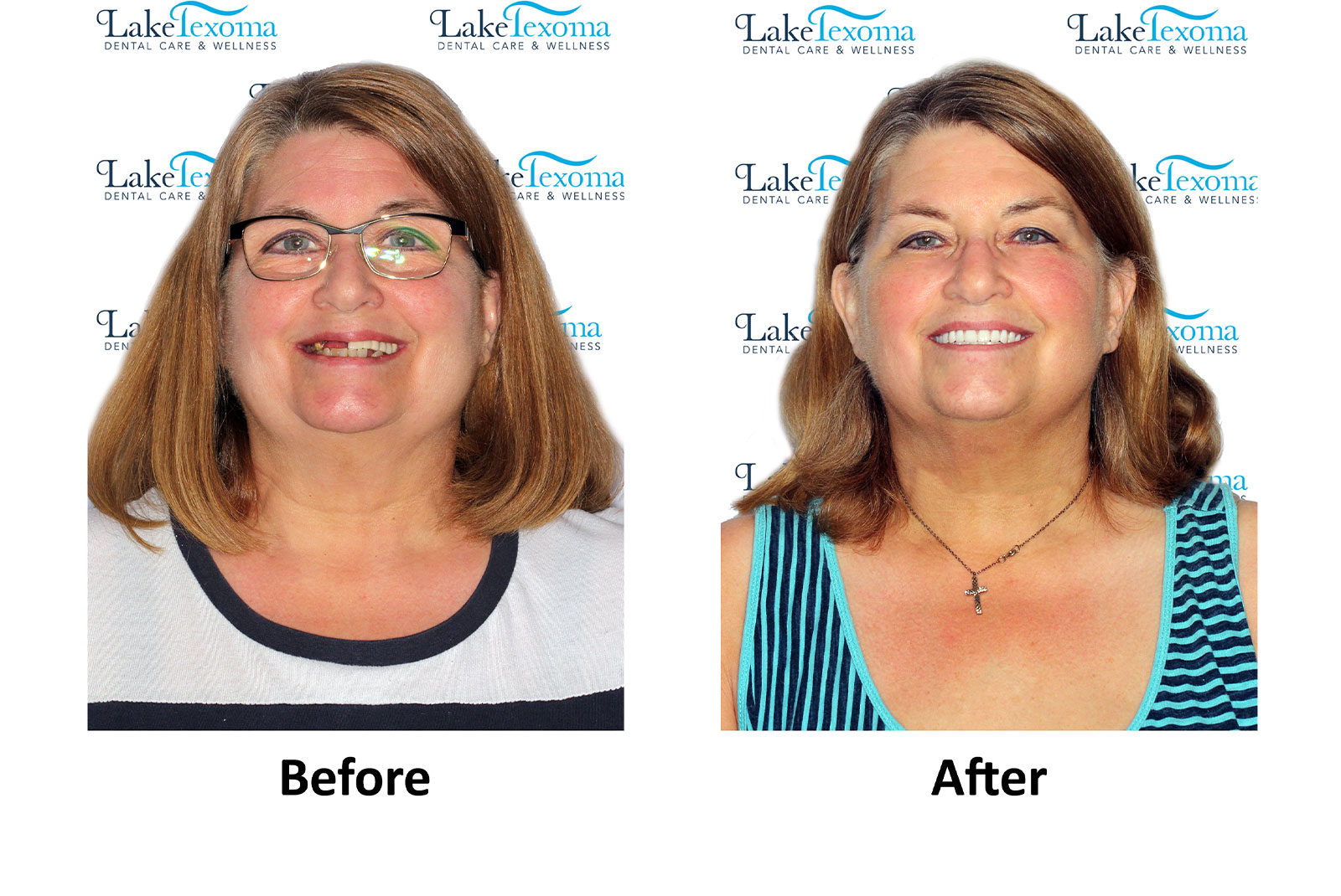 Headshot of patients before and after procedure