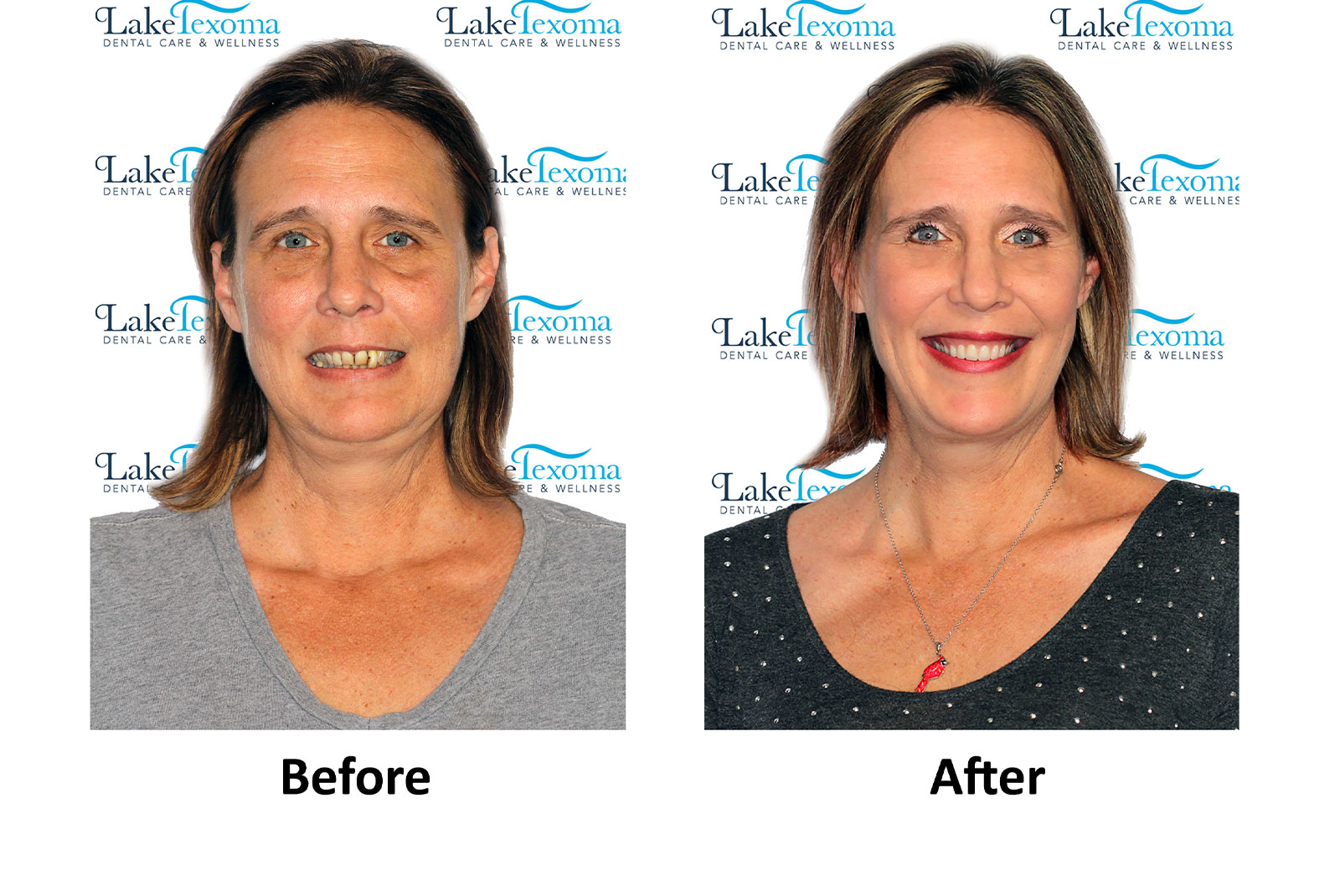 Headshot of patients before and after procedure