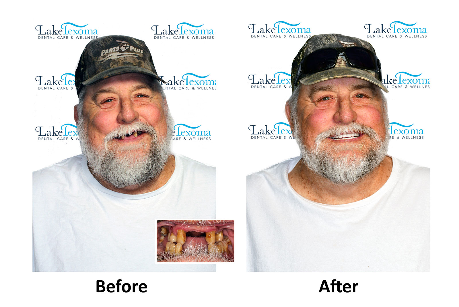 Headshot of patients before and after procedure