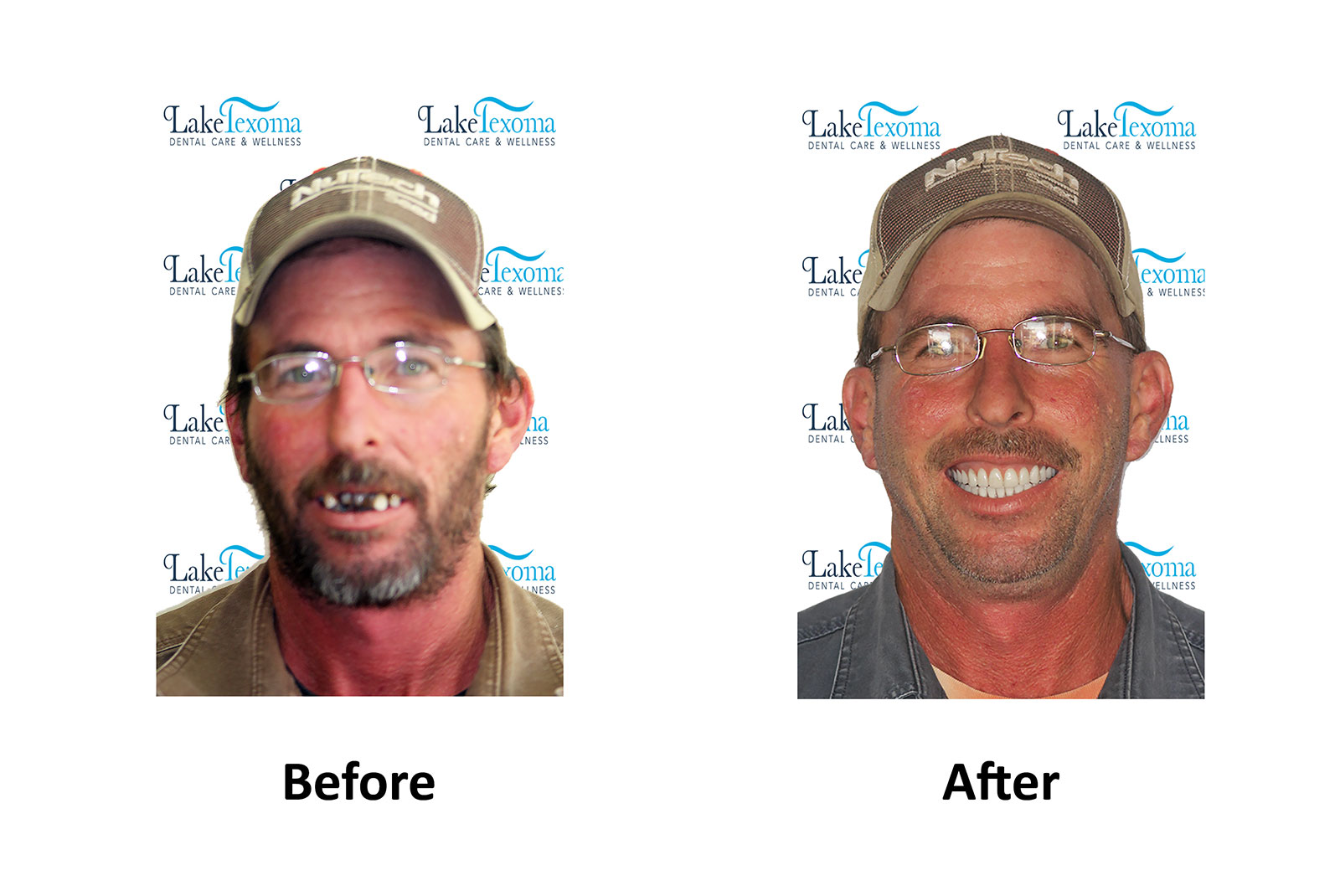 Headshot of patients before and after procedure