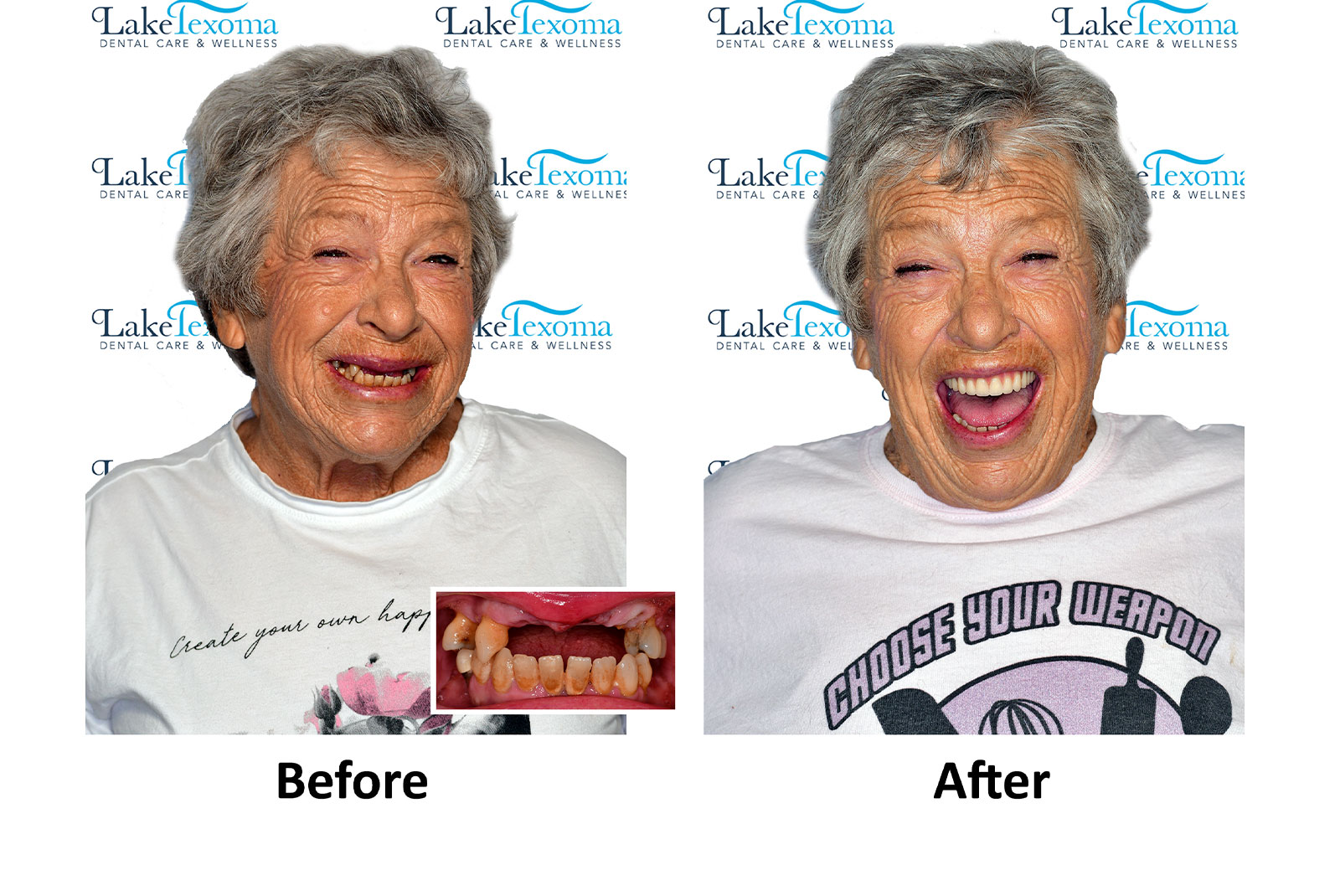 Headshot of patients before and after procedure