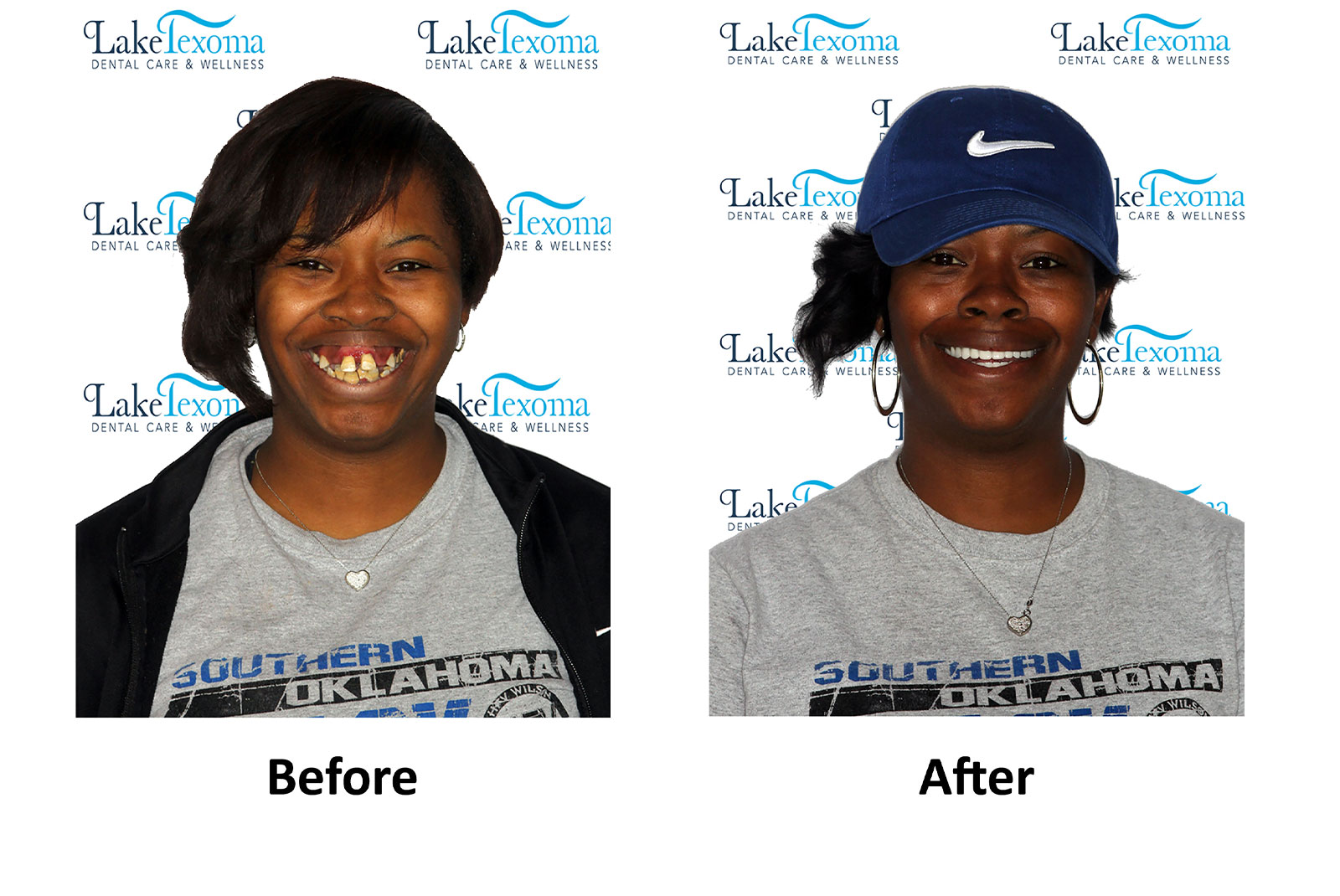Headshot of patients before and after procedure