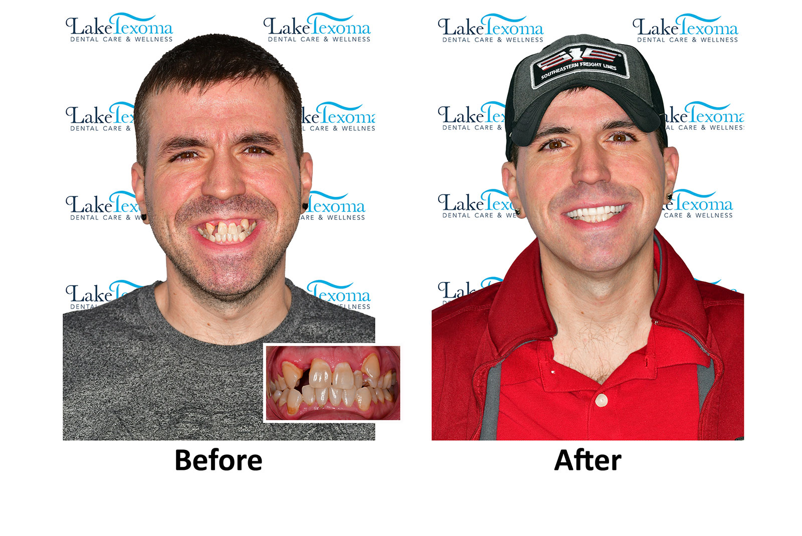 Headshot of patients before and after procedure