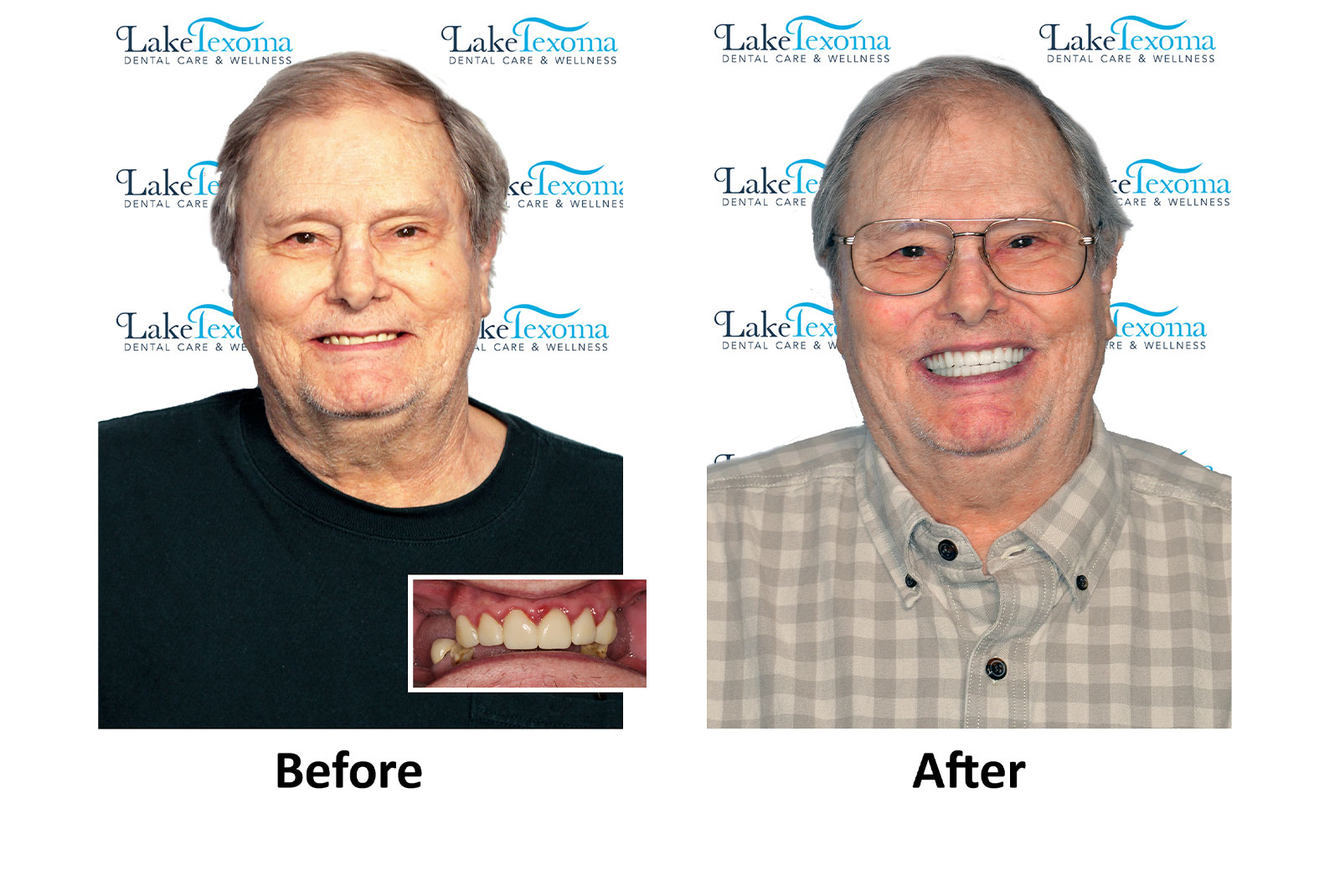 Headshot of patients before and after procedure