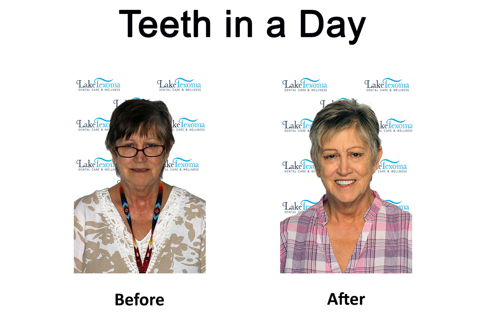 Headshot of patients before and after procedure