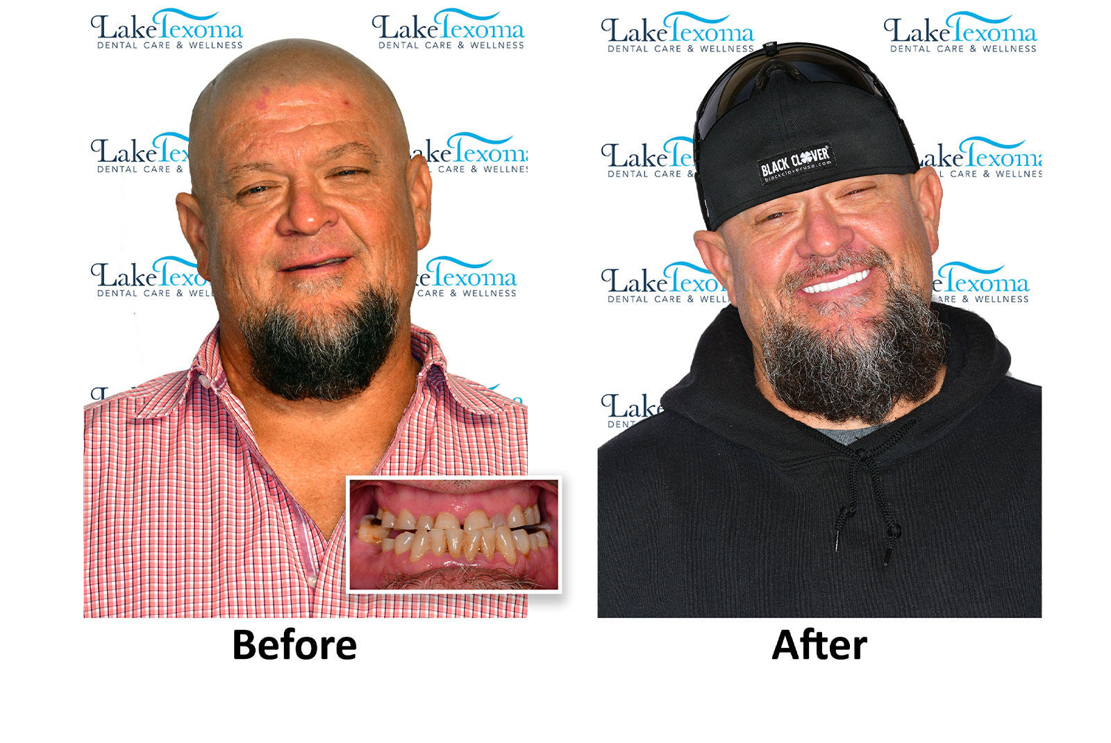 Headshot of patients before and after procedure