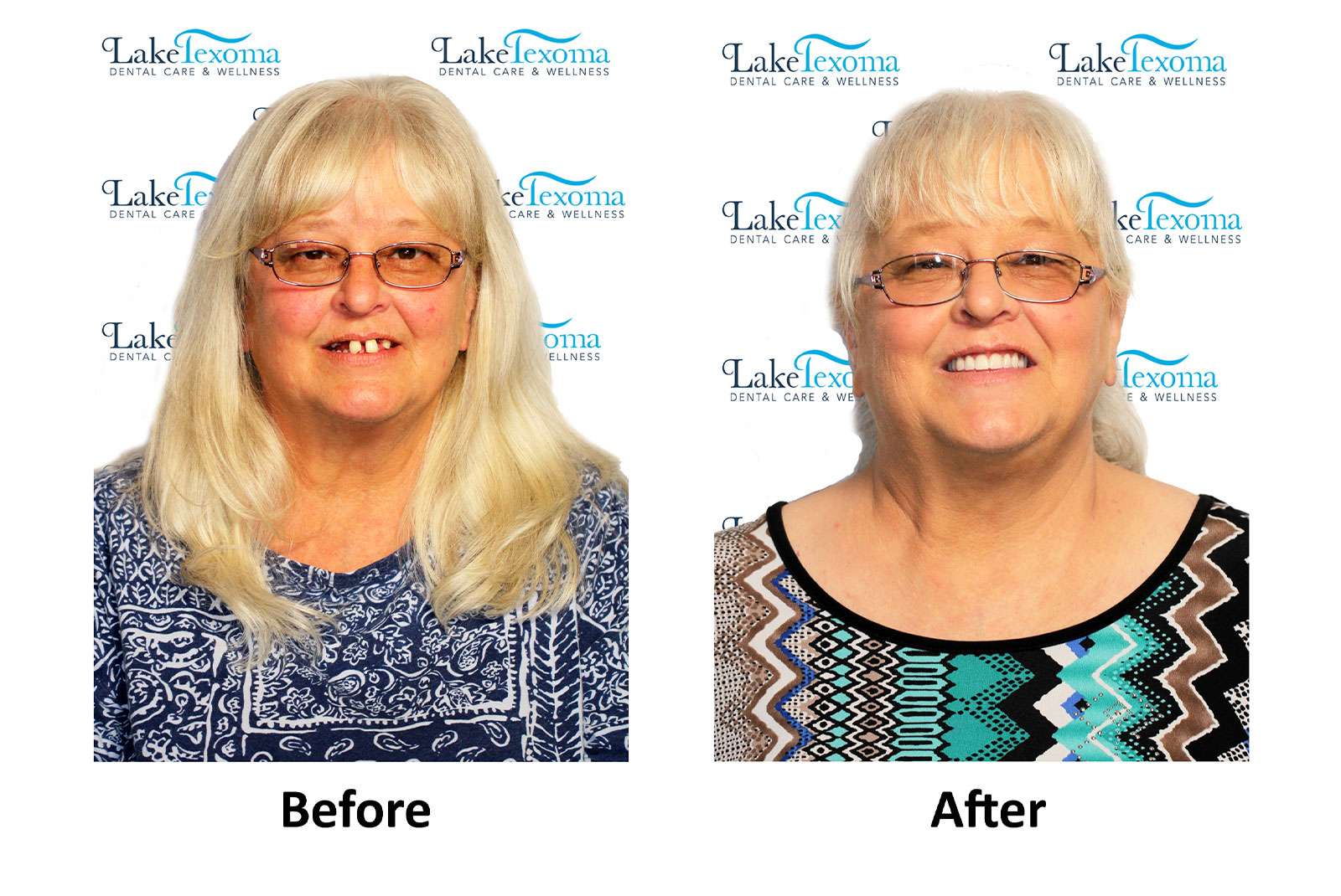 Headshot of patients before and after procedure