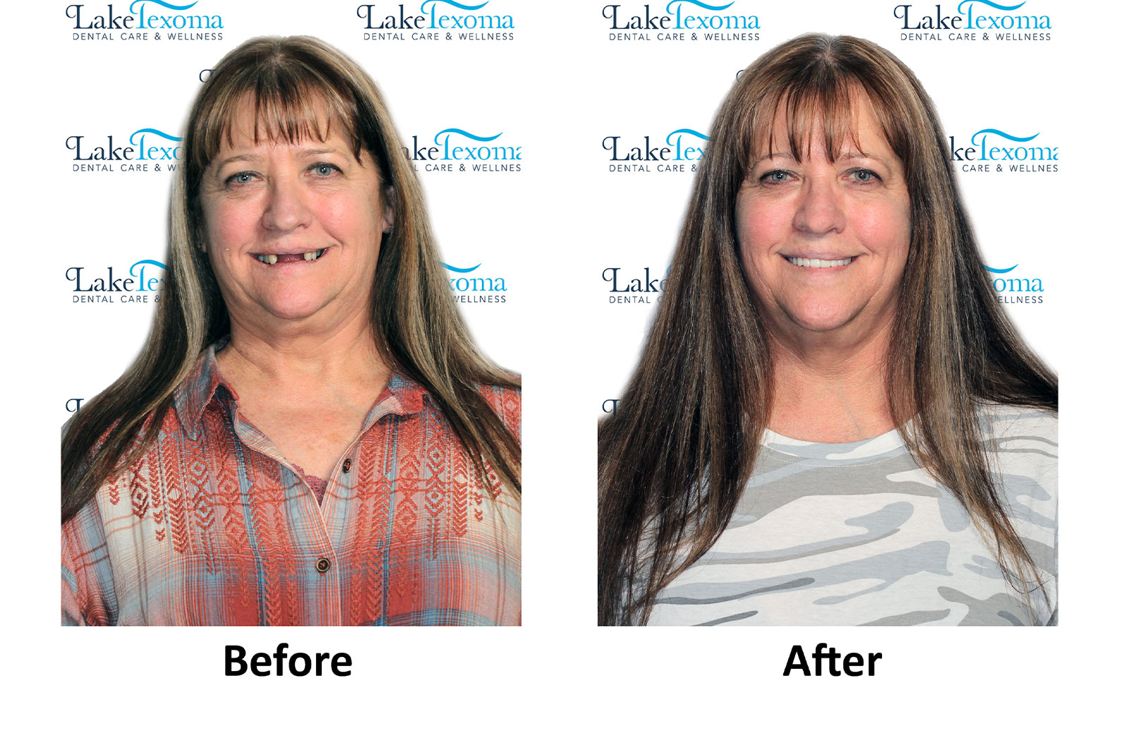 Headshot of patients before and after procedure