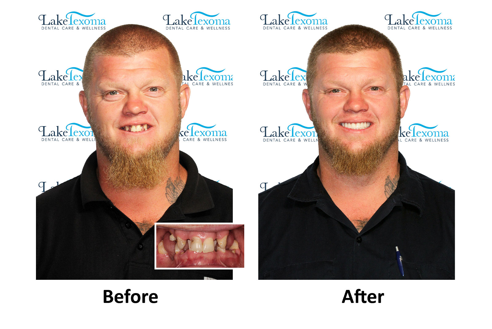 Headshot of patients before and after procedure