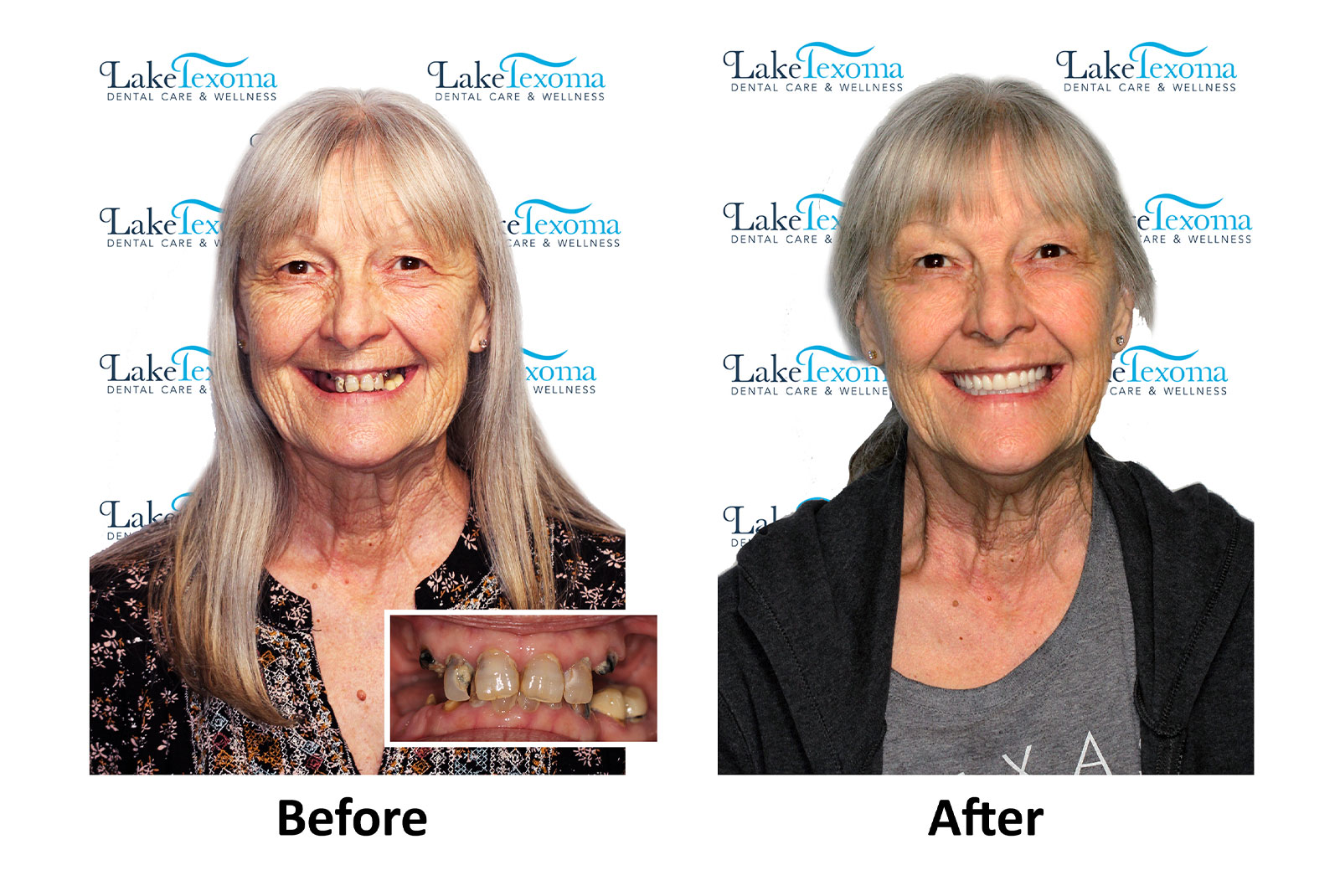 Headshot of patients before and after procedure