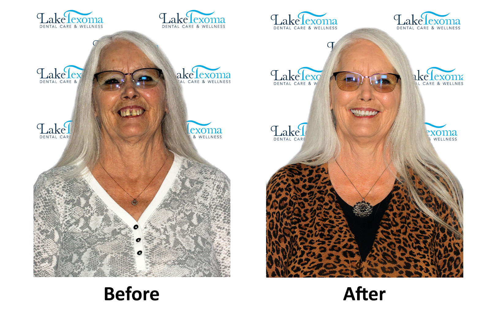 Headshot of patients before and after procedure
